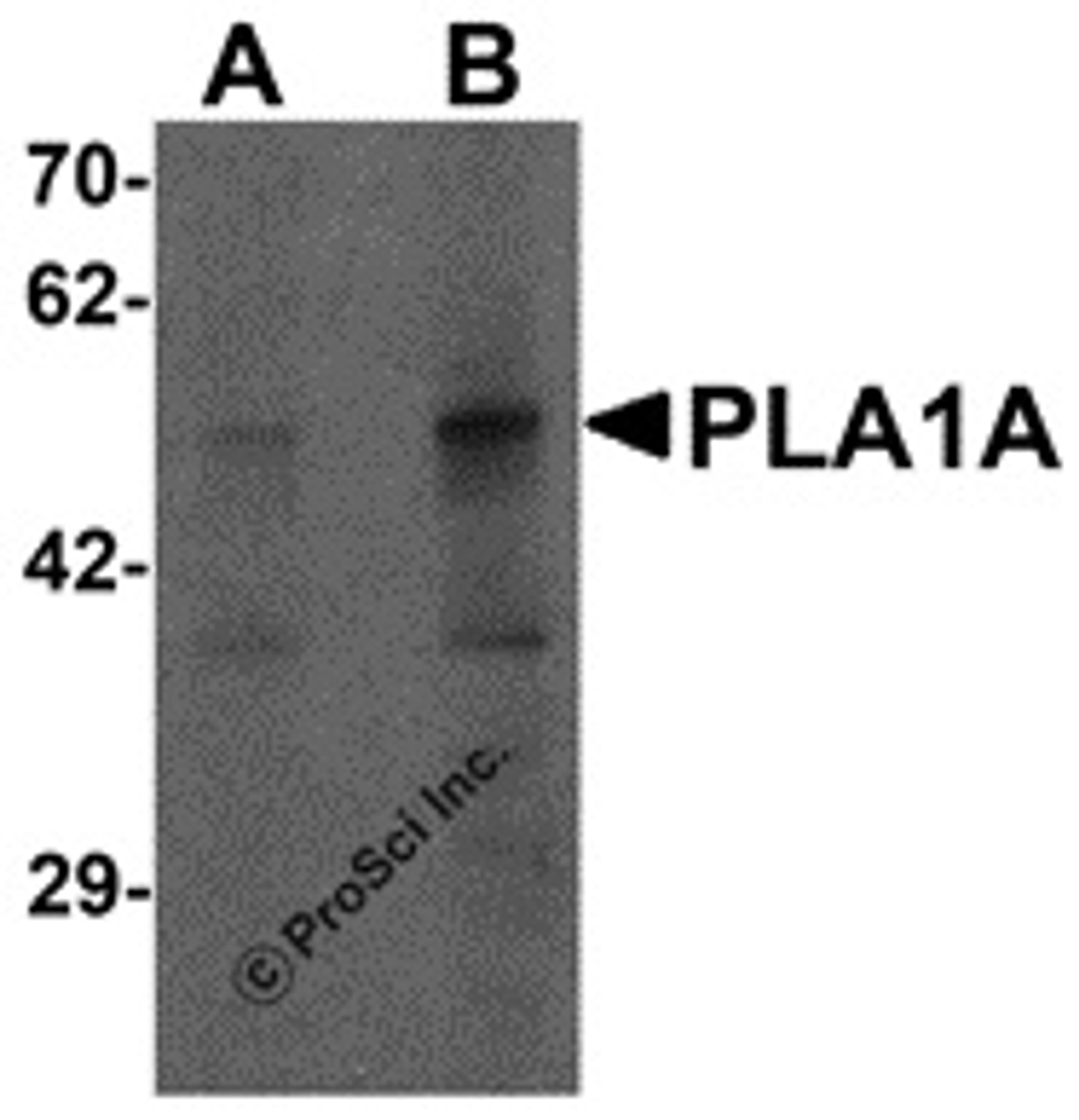 Western blot analysis of PLA1A in human kidney tissue lysate with PLA1A antibody at (A) 1 and (B) 2 μg/mL.