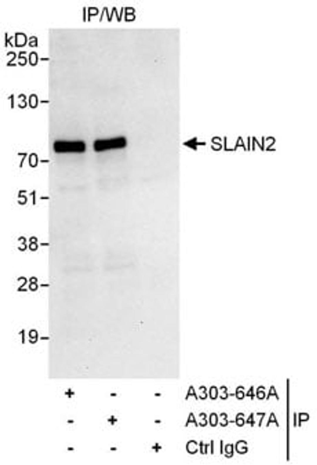 Detection of human SLAIN2 by western blot of immunoprecipitates.