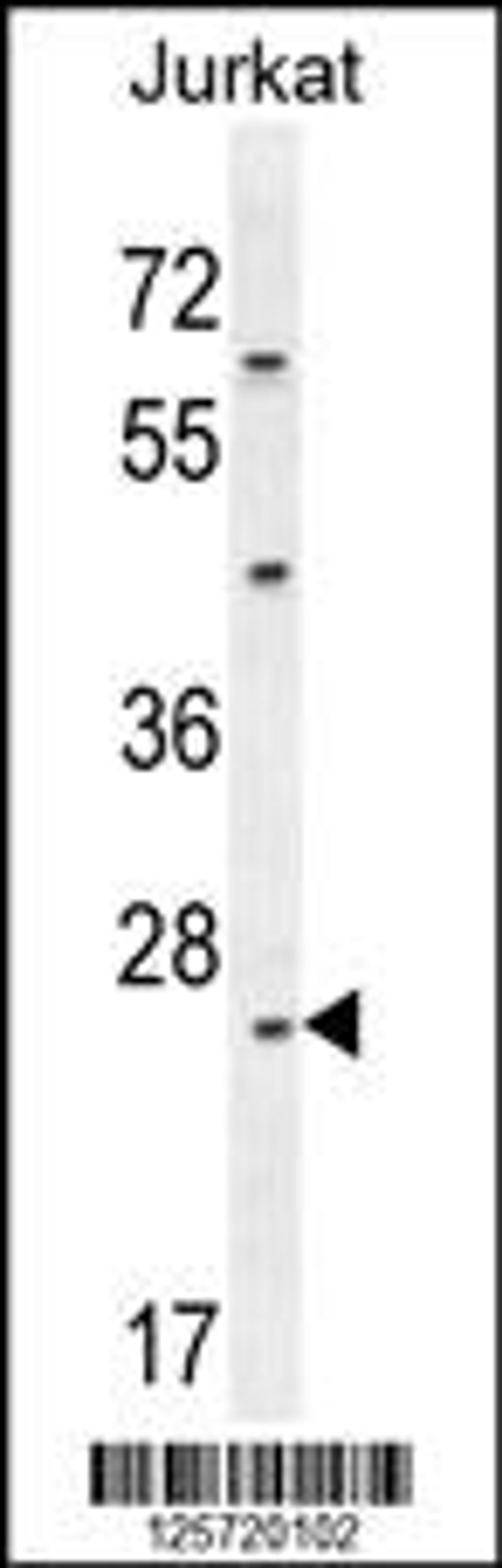 Western blot analysis in Jurkat cell line lysates (35ug/lane).