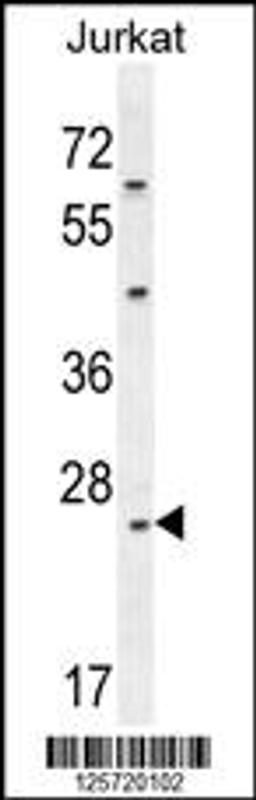 Western blot analysis in Jurkat cell line lysates (35ug/lane).