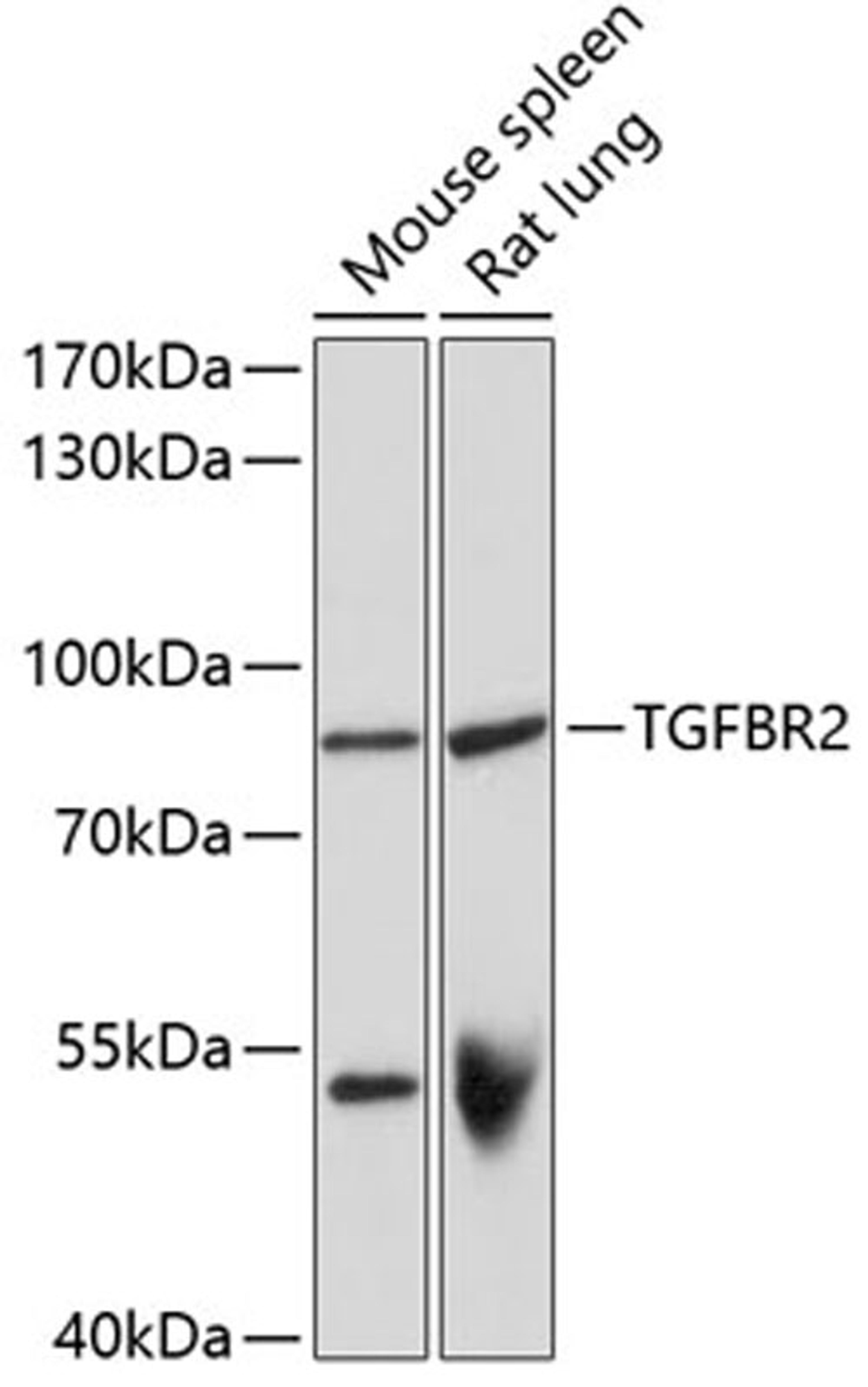 Western blot - TGFBR2 antibody (A11788)