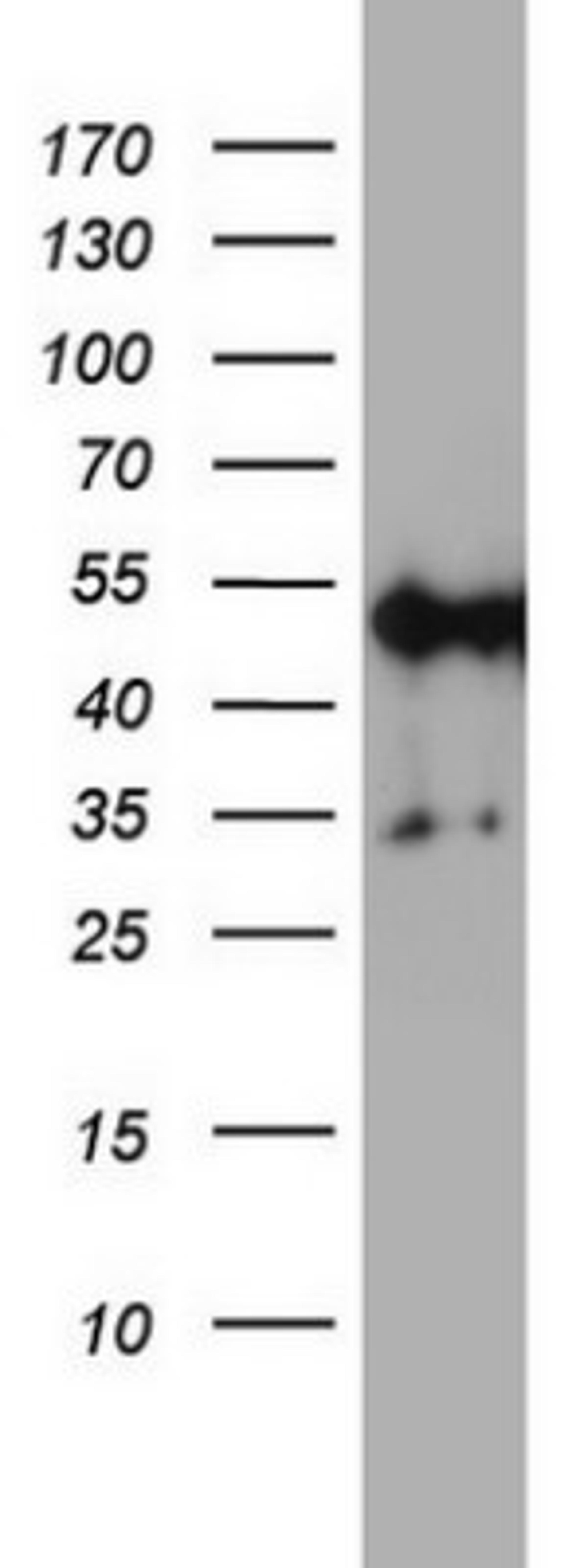 Western Blot: NDUFS2 Antibody (1D5) [NBP2-46127] - Analysis of A549 cell lysate (35ug) by using NDUFS2 monoclonal antibody.