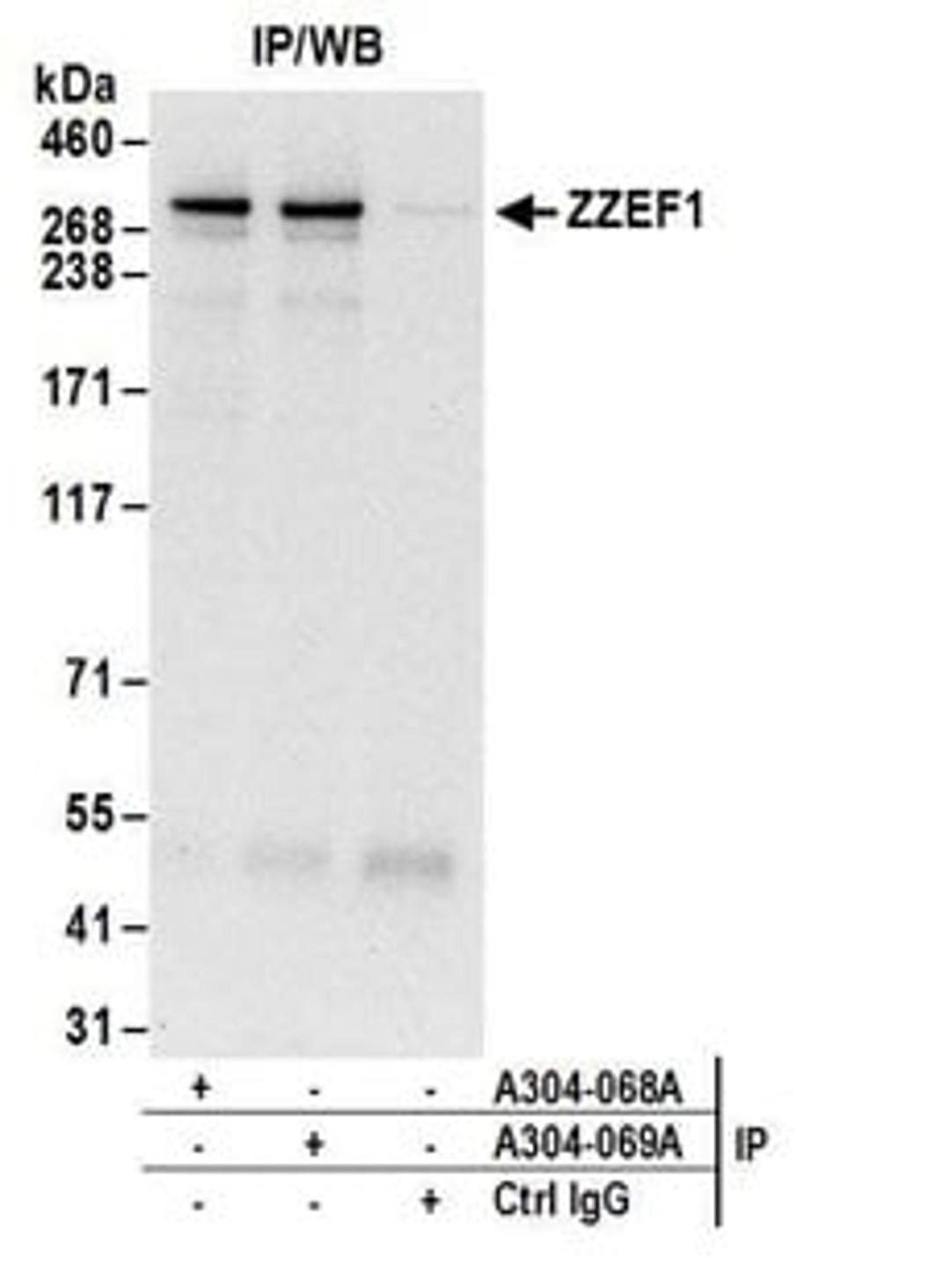 Detection of human ZZEF1 by western blot of immunoprecipitates.