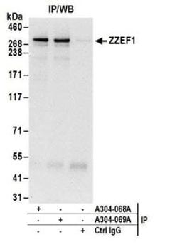 Detection of human ZZEF1 by western blot of immunoprecipitates.