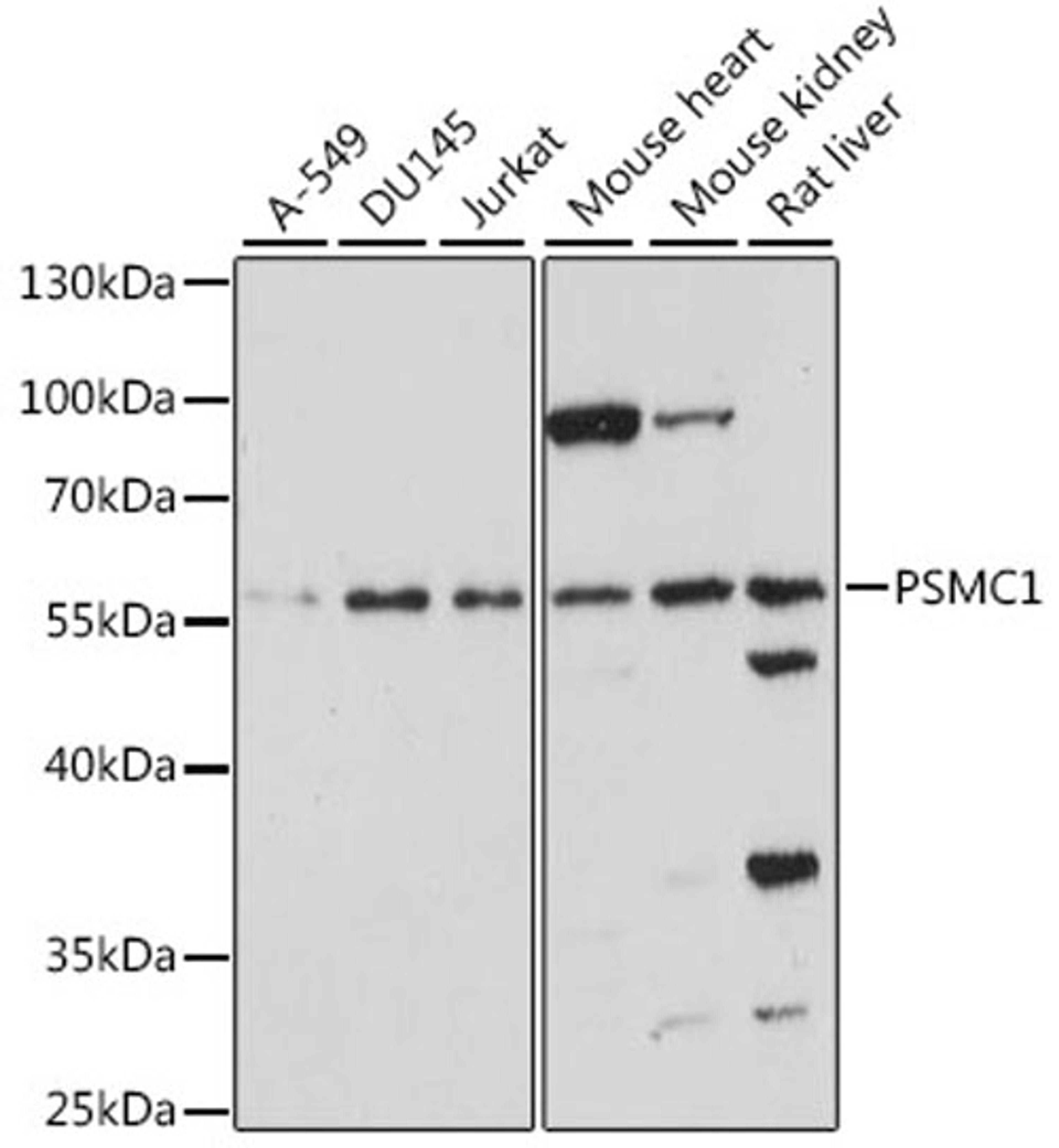 Western blot - PSMC1 antibody (A15712)