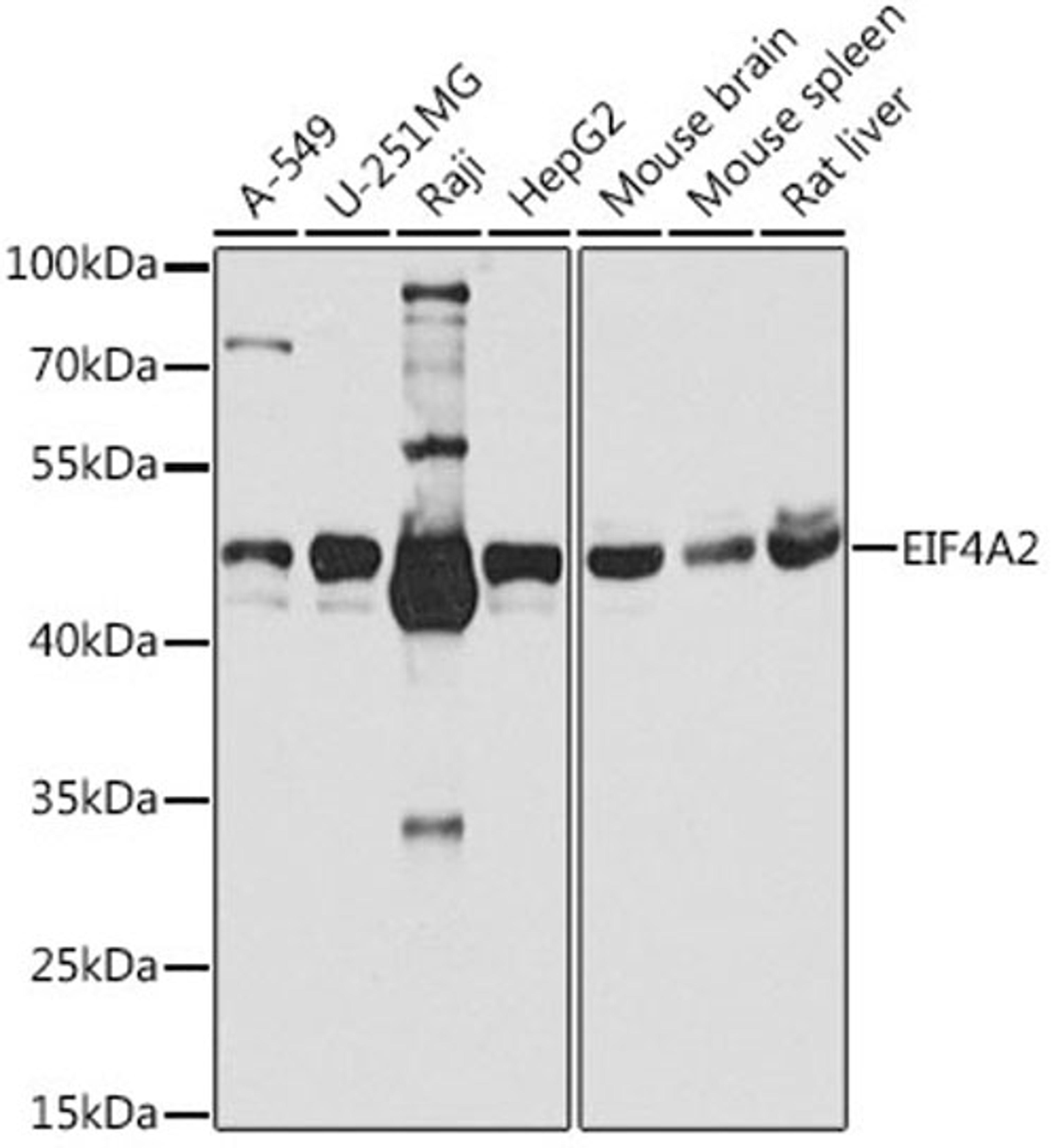 Western blot - EIF4A2 antibody (A3849)