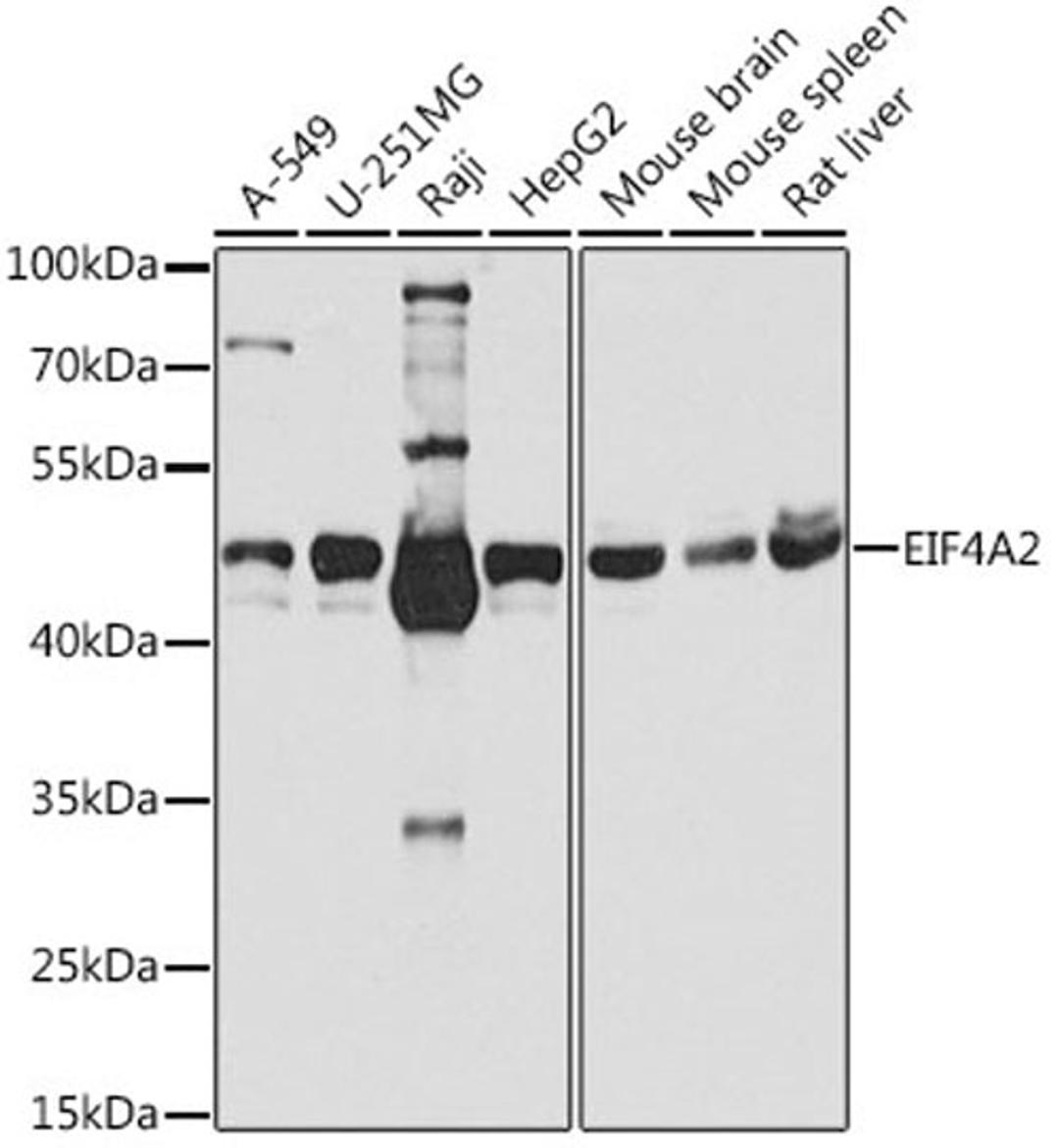 Western blot - EIF4A2 antibody (A3849)