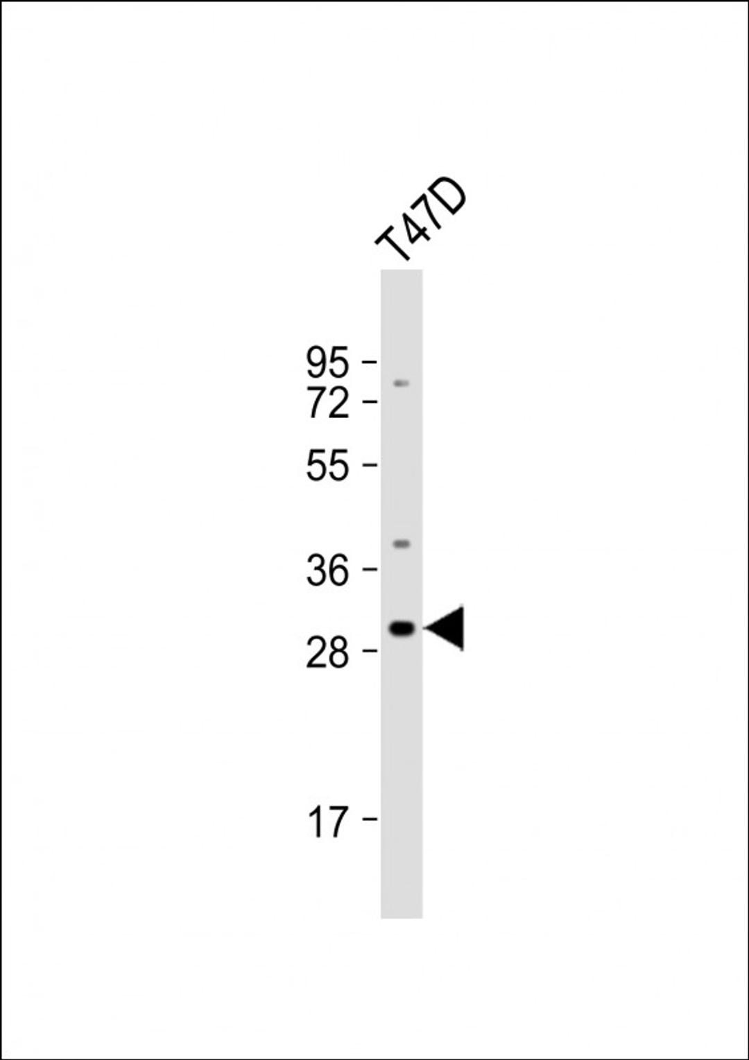 Western Blot at 1:1000 dilution + T47D whole cell lysate Lysates/proteins at 20 ug per lane.