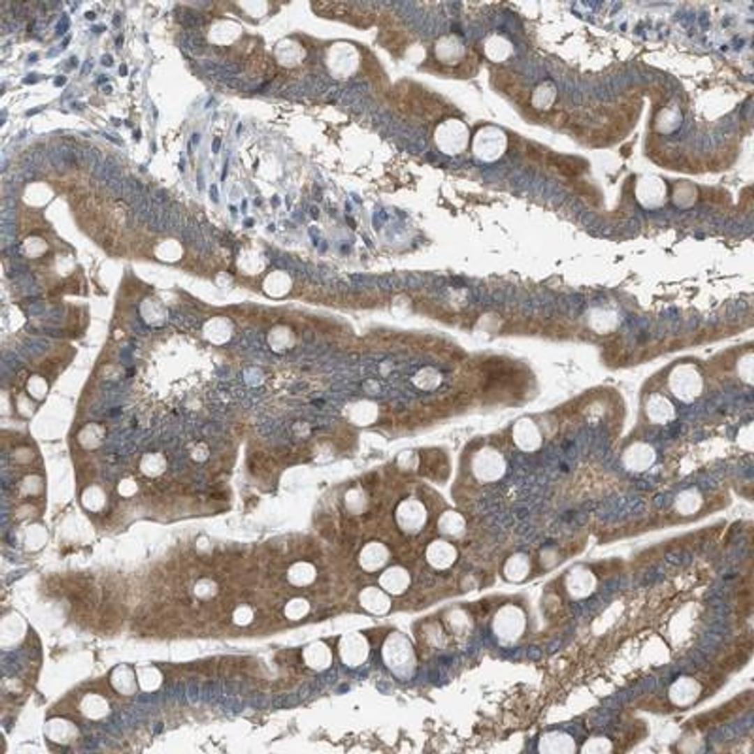 Immunohistochemistry-Paraffin: Sigma-1 R/OPRS1 Antibody [NBP1-82479] - OPRS1 Antibody [NBP1-82479] - Immunohistochemical staining of human small intestine shows distinct positivity in glandular cells.