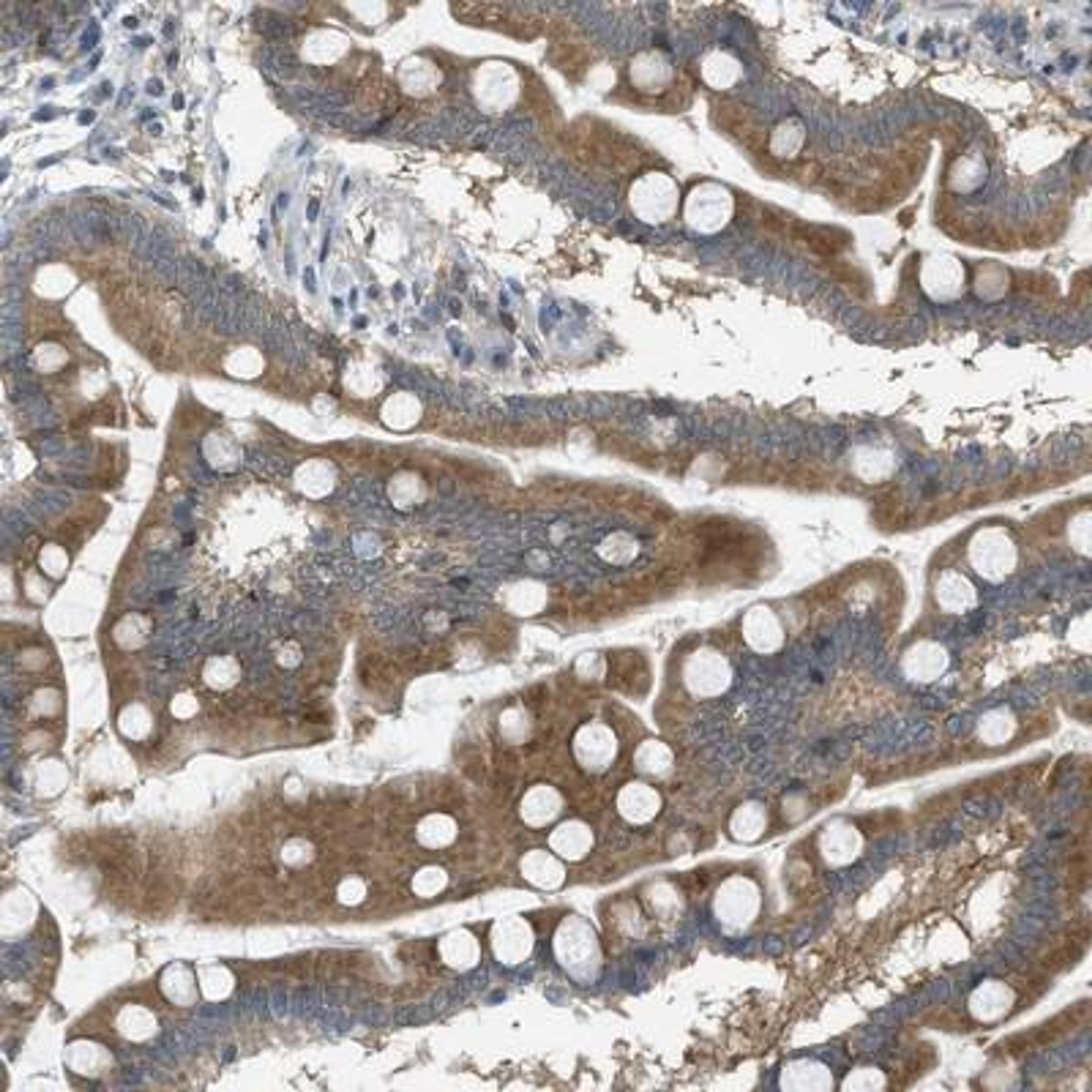 Immunohistochemistry-Paraffin: Sigma-1 R/OPRS1 Antibody [NBP1-82479] - OPRS1 Antibody [NBP1-82479] - Immunohistochemical staining of human small intestine shows distinct positivity in glandular cells.