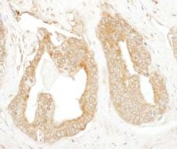 Detection of human p600 by immunohistochemistry.