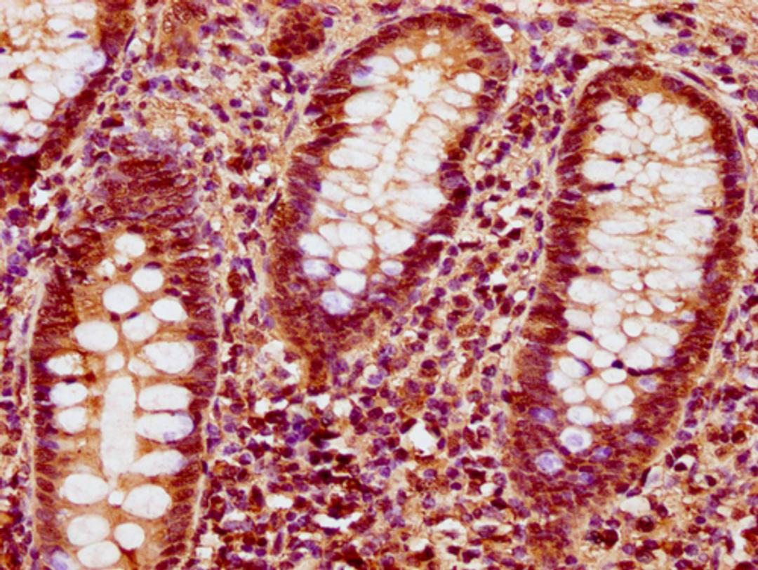 IHC image of CSB-PA010378OA89nforHU diluted at 1:10 and staining in paraffin-embedded human appendix tissue performed on a Leica BondTM system. After dewaxing and hydration, antigen retrieval was mediated by high pressure in a citrate buffer (pH 6.0). Section was blocked with 10% normal goat serum 30min at RT. Then primary antibody (1% BSA) was incubated at 4°C overnight. The primary is detected by a biotinylated secondary antibody and visualized using an HRP conjugated SP system.