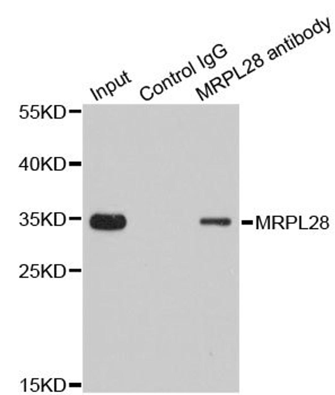 Immunoprecipitation analysis of 200ug extracts of 293T cells using 1ug MRPL28 antibody