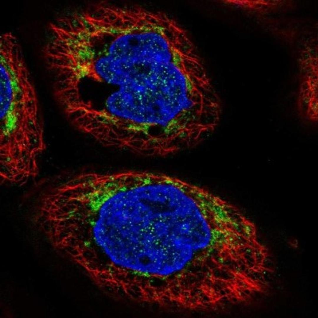 Immunocytochemistry/Immunofluorescence: CHCHD6 Antibody [NBP1-91779] - Staining of human cell line A-431 shows positivity in mitochondria.