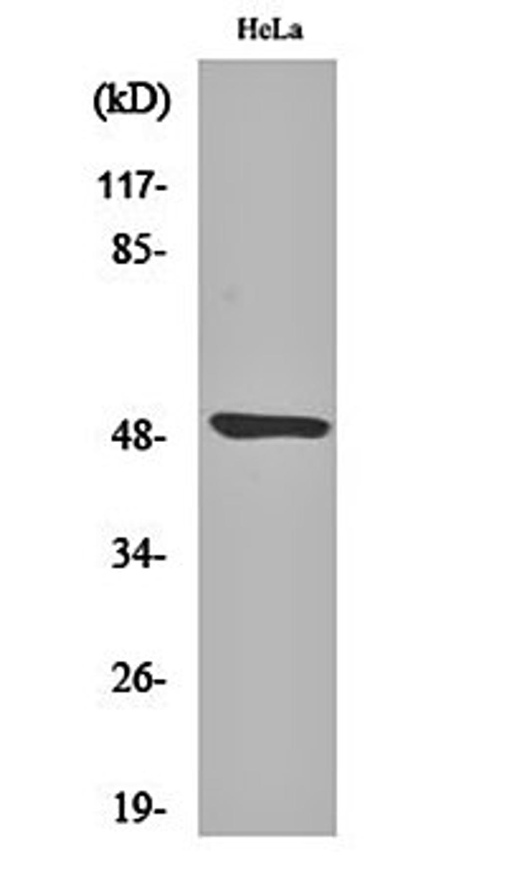 Western blot analysis of Hela cell lysates using Myt 1 antibody