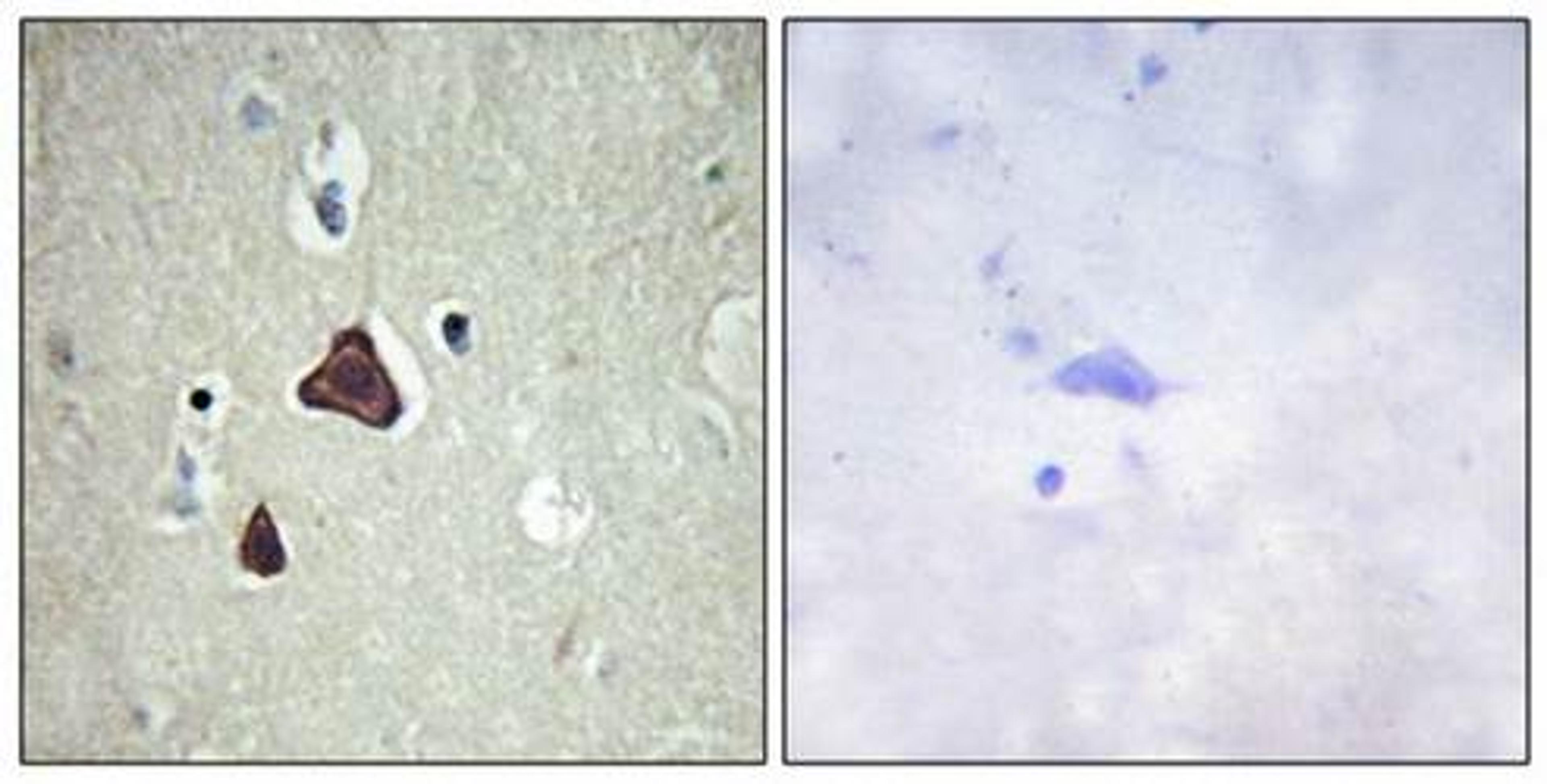 Immunohistochemical analysis of formalin-fixed and paraffin-embedded human brain tissue using Collagen IX alpha3 antibody