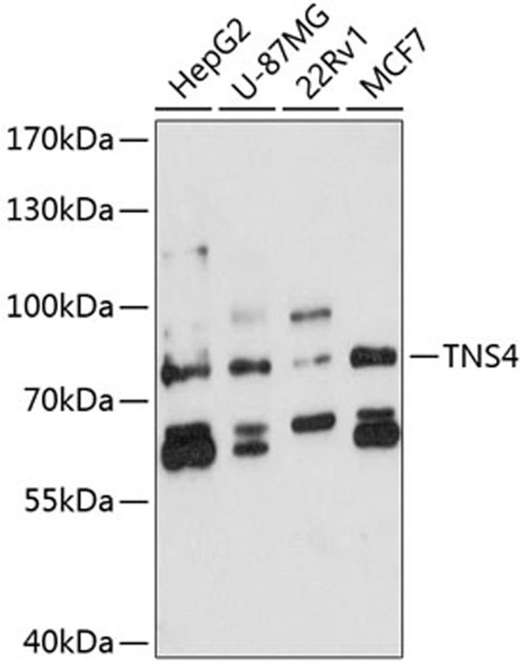 Western blot - TNS4 antibody (A8731)