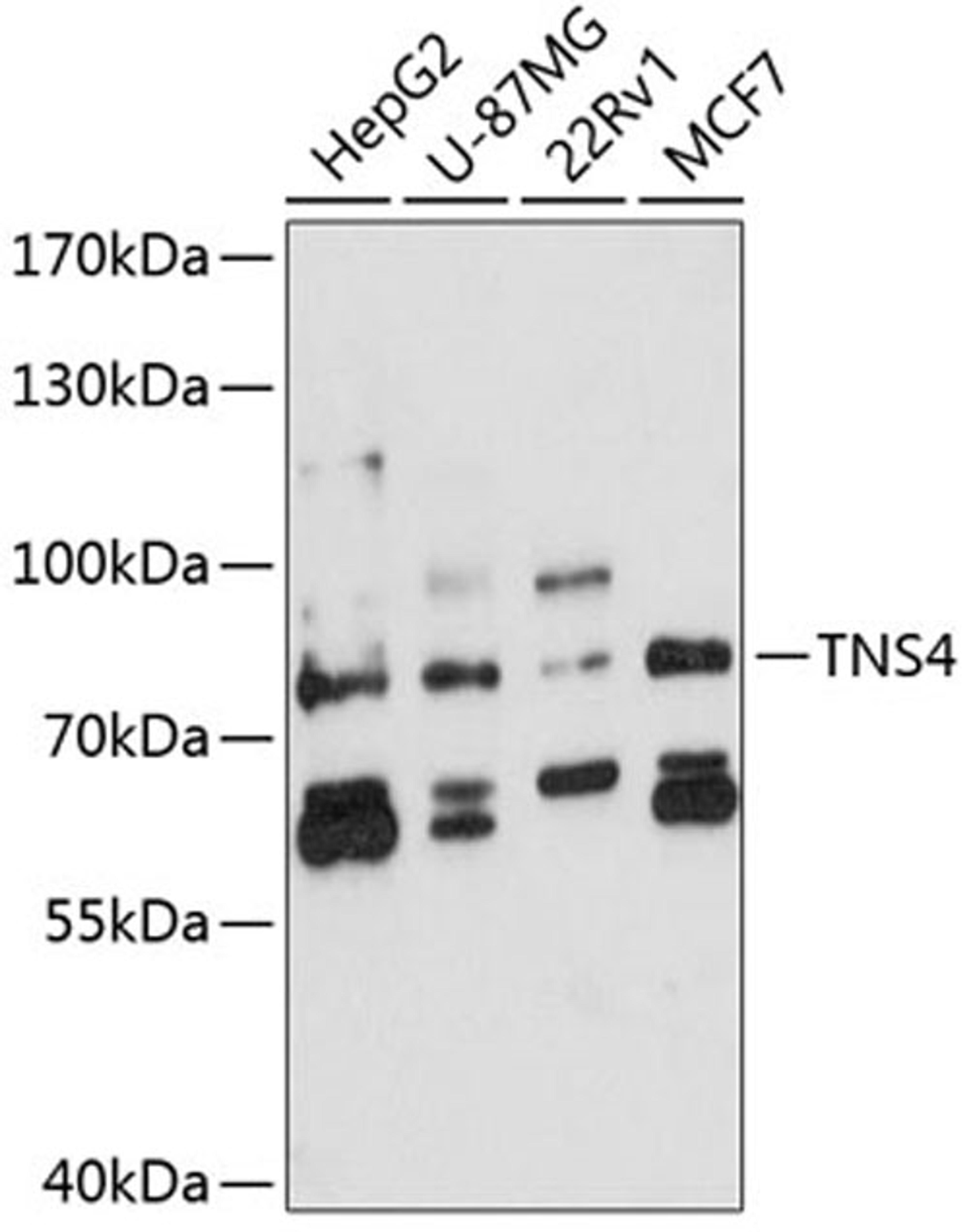 Western blot - TNS4 antibody (A8731)