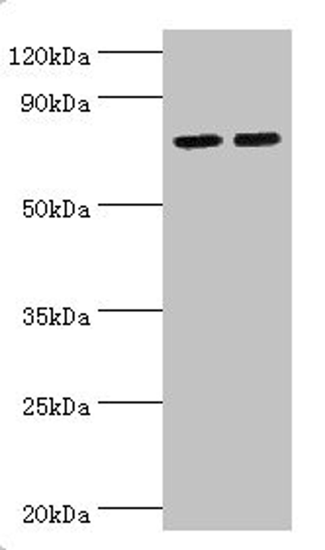 Western blot. All lanes: Arachidonate 15-lipoxygenase B antibody at 11ug/ml. Lane 1: MCF-7 whole cell lysate. Lane 2: 293T whole cell lysate. Secondary. Goat polyclonal to rabbit IgG at 1/10000 dilution. Predicted band size: 76, 68, 70, 73 kDa. Observed band size: 76 kDa. 