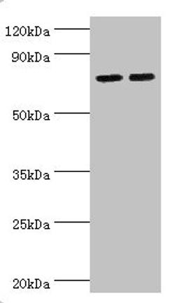 Western blot. All lanes: Arachidonate 15-lipoxygenase B antibody at 11ug/ml. Lane 1: MCF-7 whole cell lysate. Lane 2: 293T whole cell lysate. Secondary. Goat polyclonal to rabbit IgG at 1/10000 dilution. Predicted band size: 76, 68, 70, 73 kDa. Observed band size: 76 kDa. 