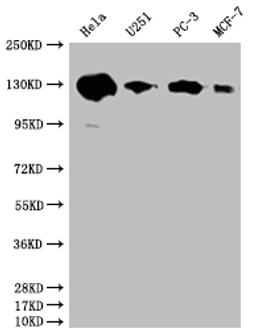 Western Blot. Positive WB detected in: Hela whole cell lysate, U251 whole cell lysate, PC3 whole cell lysate, MCF-7 whole cell lysate. All lanes: PKN2 antibody at 1:2000. Secondary. Goat polyclonal to rabbit IgG at 1/50000 dilution. Predicted band size: 113, 117, 112 kDa. Observed band size: 130 kDa. 