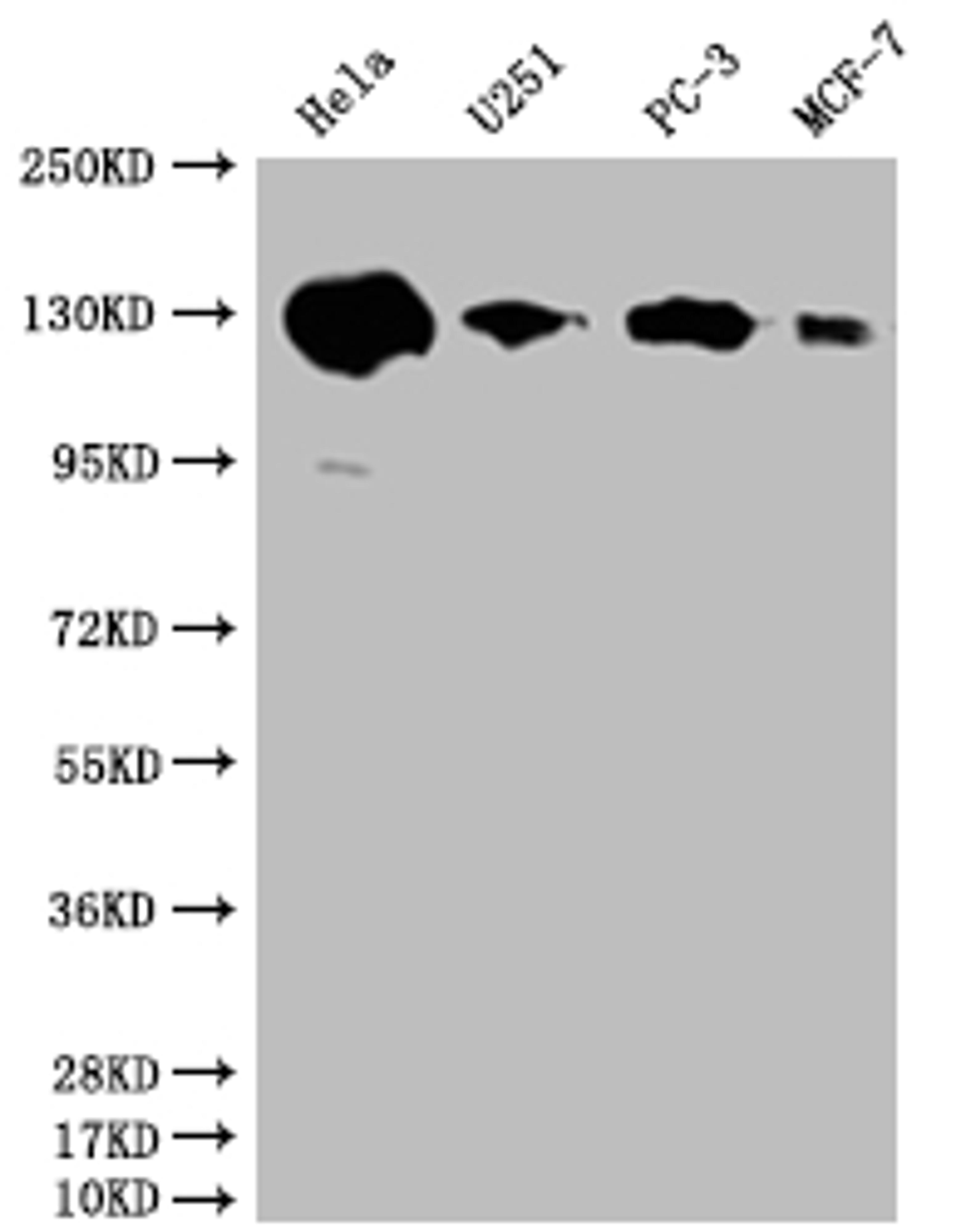 Western Blot. Positive WB detected in: Hela whole cell lysate, U251 whole cell lysate, PC3 whole cell lysate, MCF-7 whole cell lysate. All lanes: PKN2 antibody at 1:2000. Secondary. Goat polyclonal to rabbit IgG at 1/50000 dilution. Predicted band size: 113, 117, 112 kDa. Observed band size: 130 kDa. 