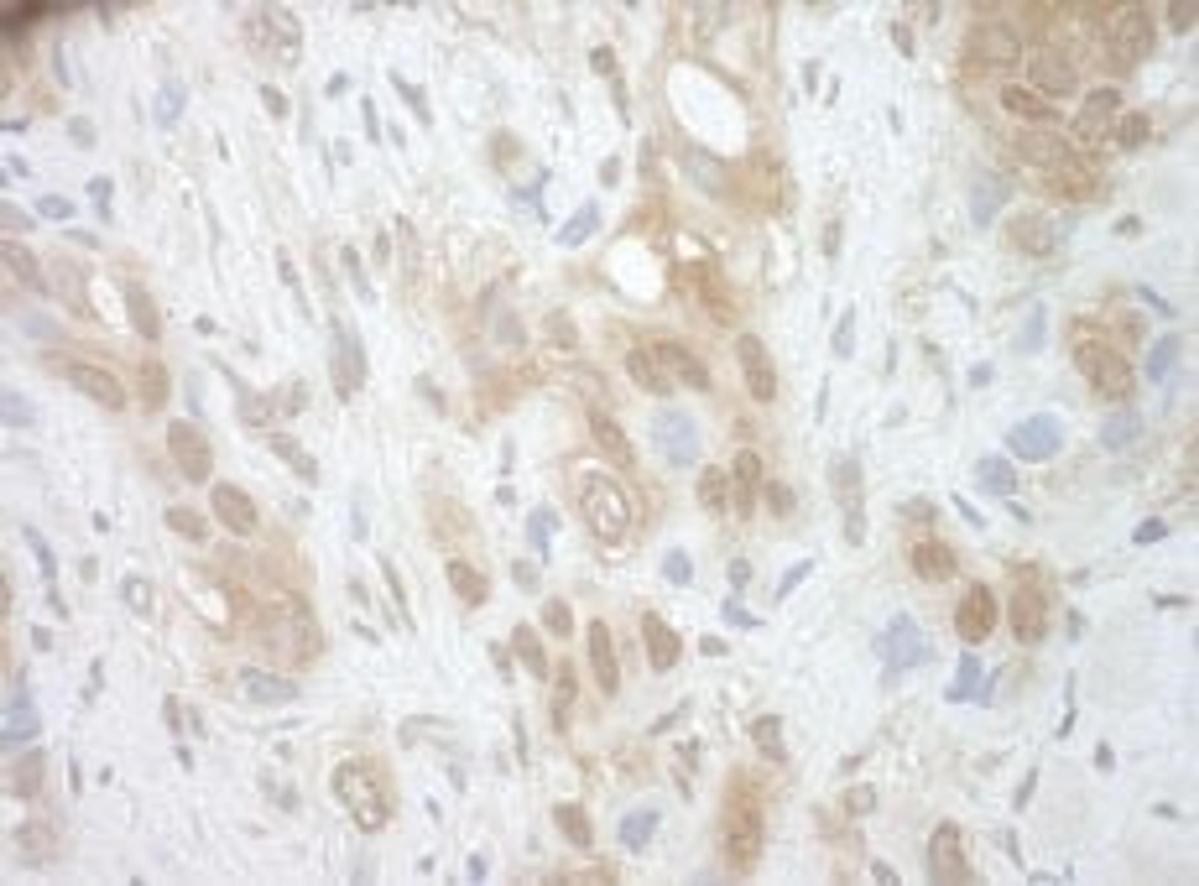 Detection of human RECQ5 by immunohistochemistry.