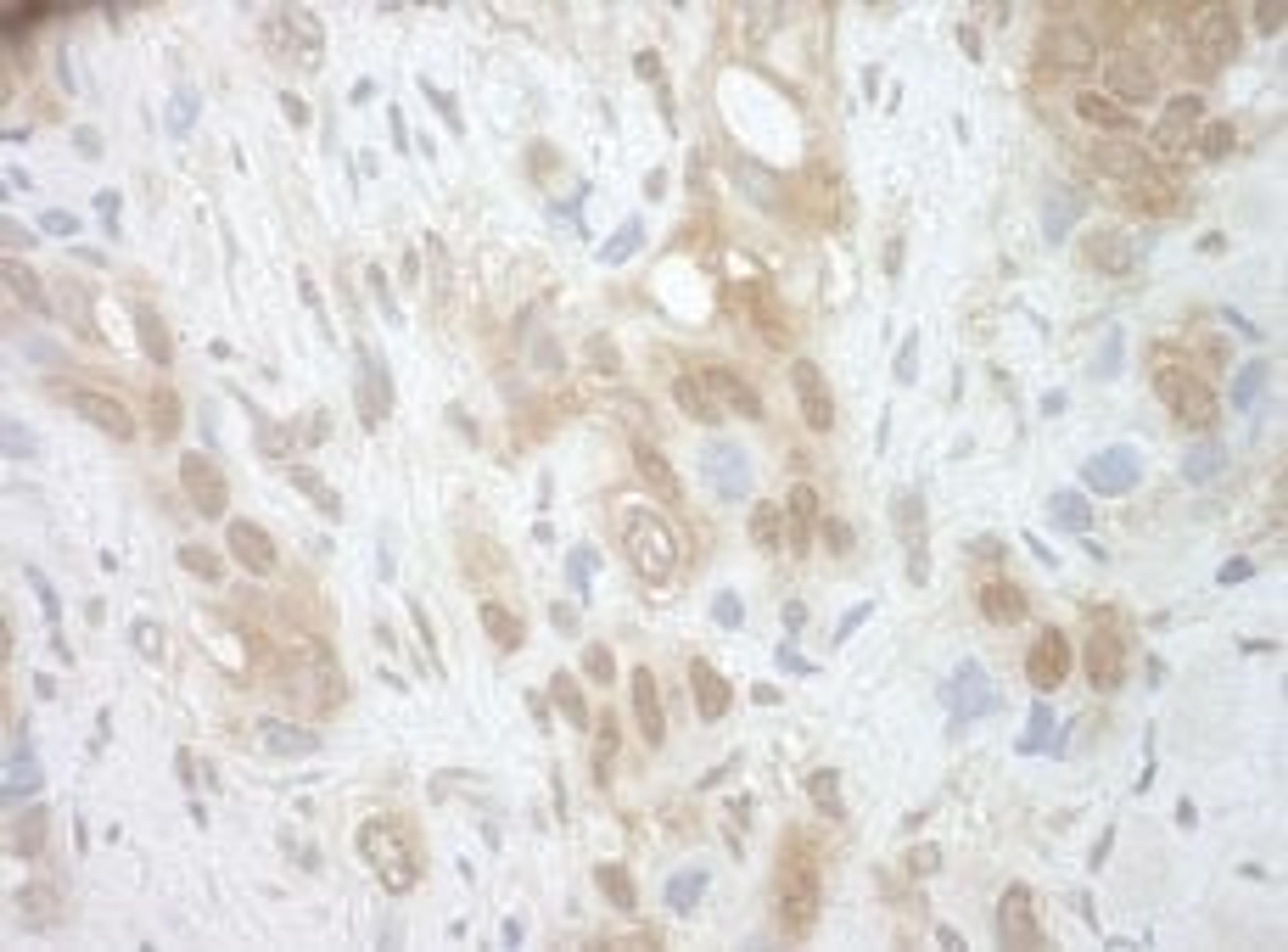 Detection of human RECQ5 by immunohistochemistry.