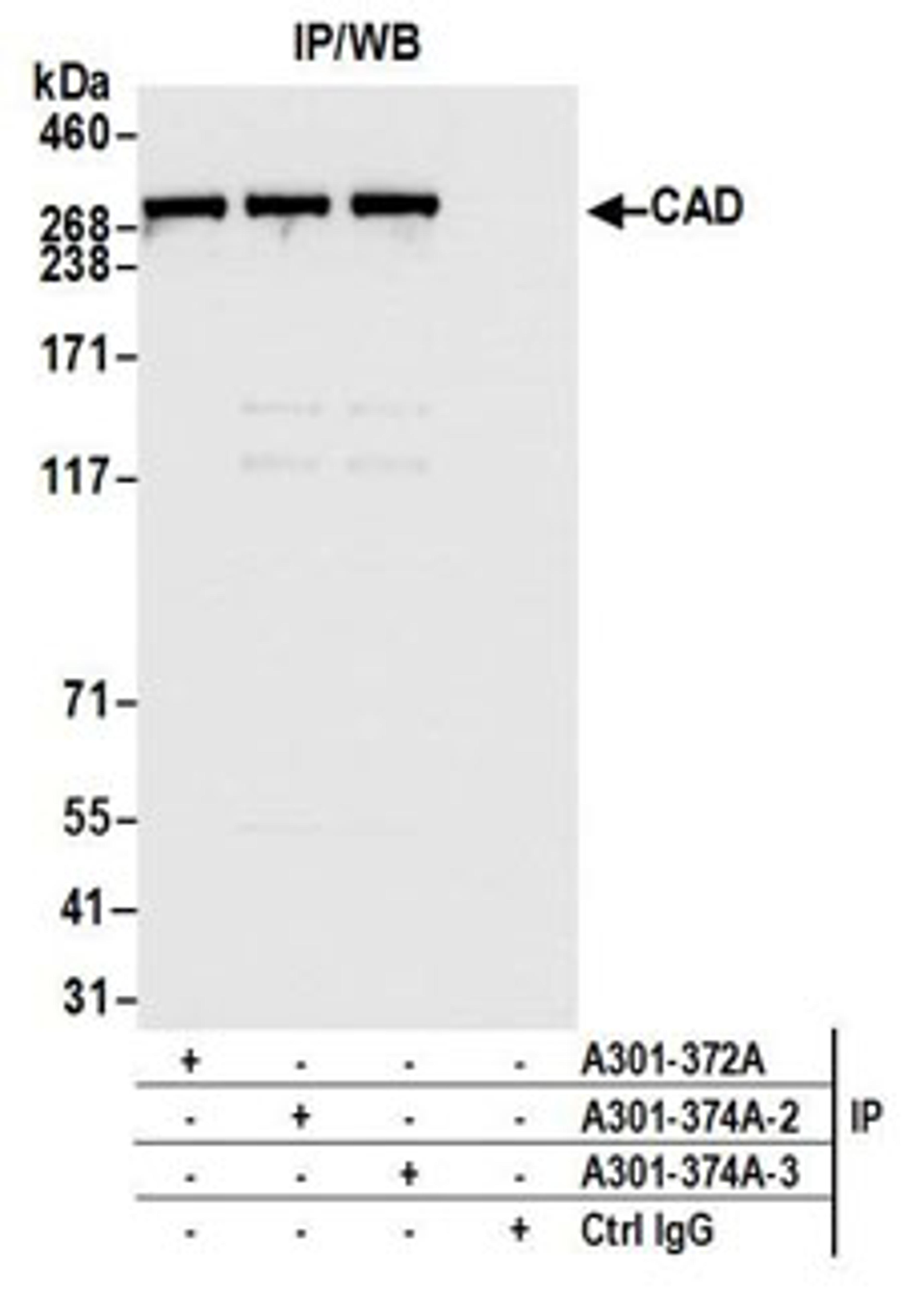 Detection of human CAD by western blot of immunoprecipitates.