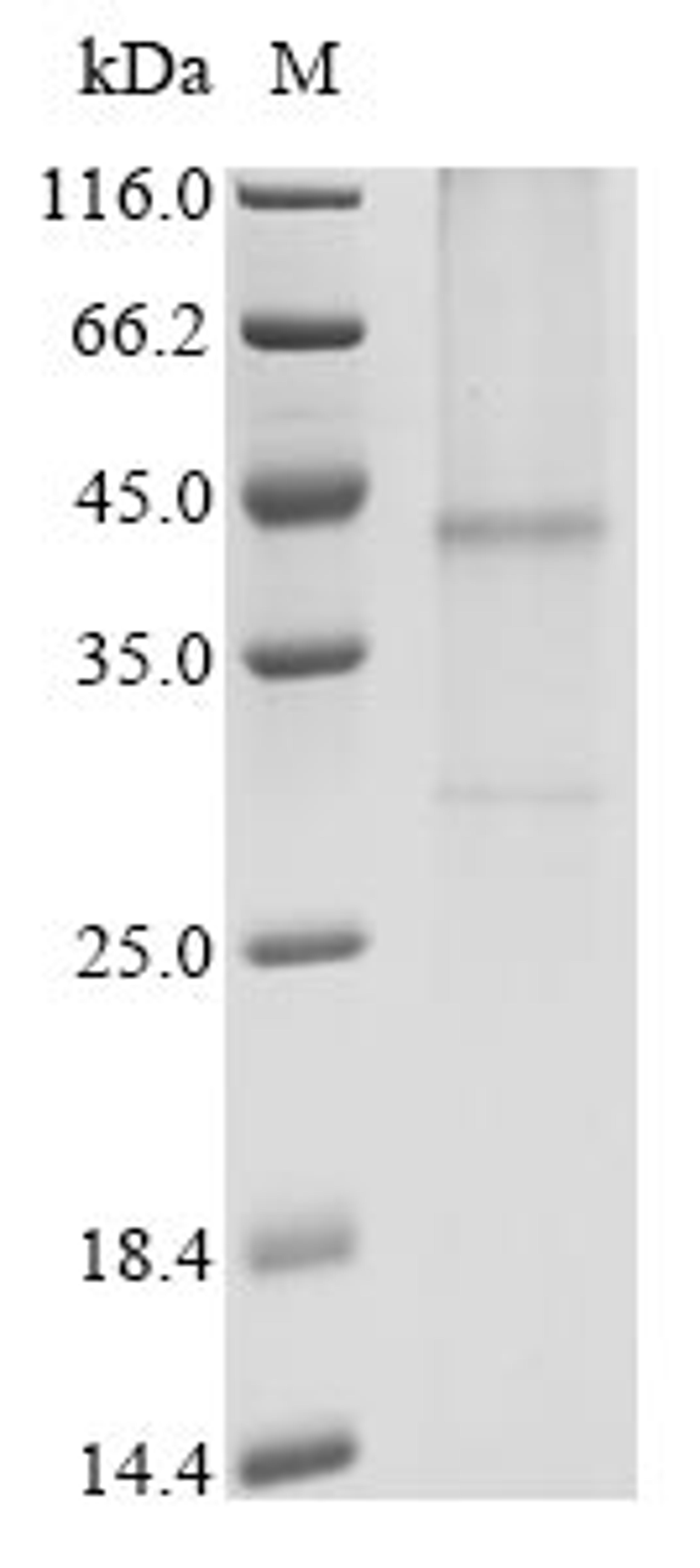 (Tris-Glycine gel) Discontinuous SDS-PAGE (reduced) with 5% enrichment gel and 15% separation gel.