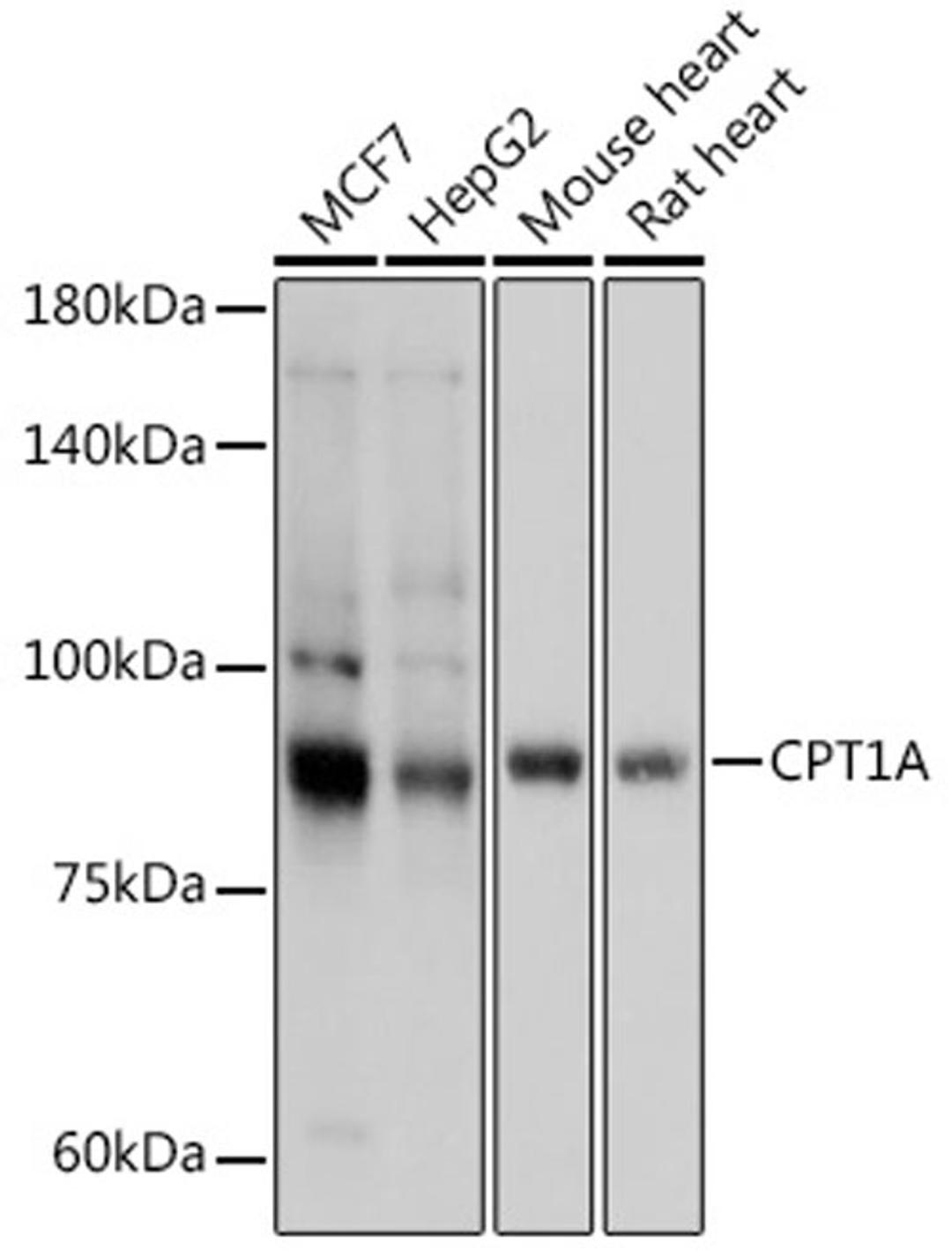 Western blot - CPT1A antibody (A5307)