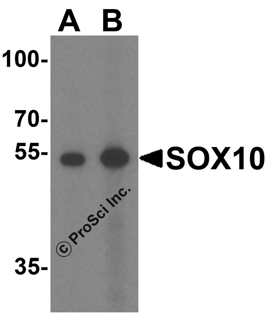 Western blot analysis of SOX10 in rat heart tissue lysate with SOX10 antibody at (A) 1 and (B) 2 μg/mL.