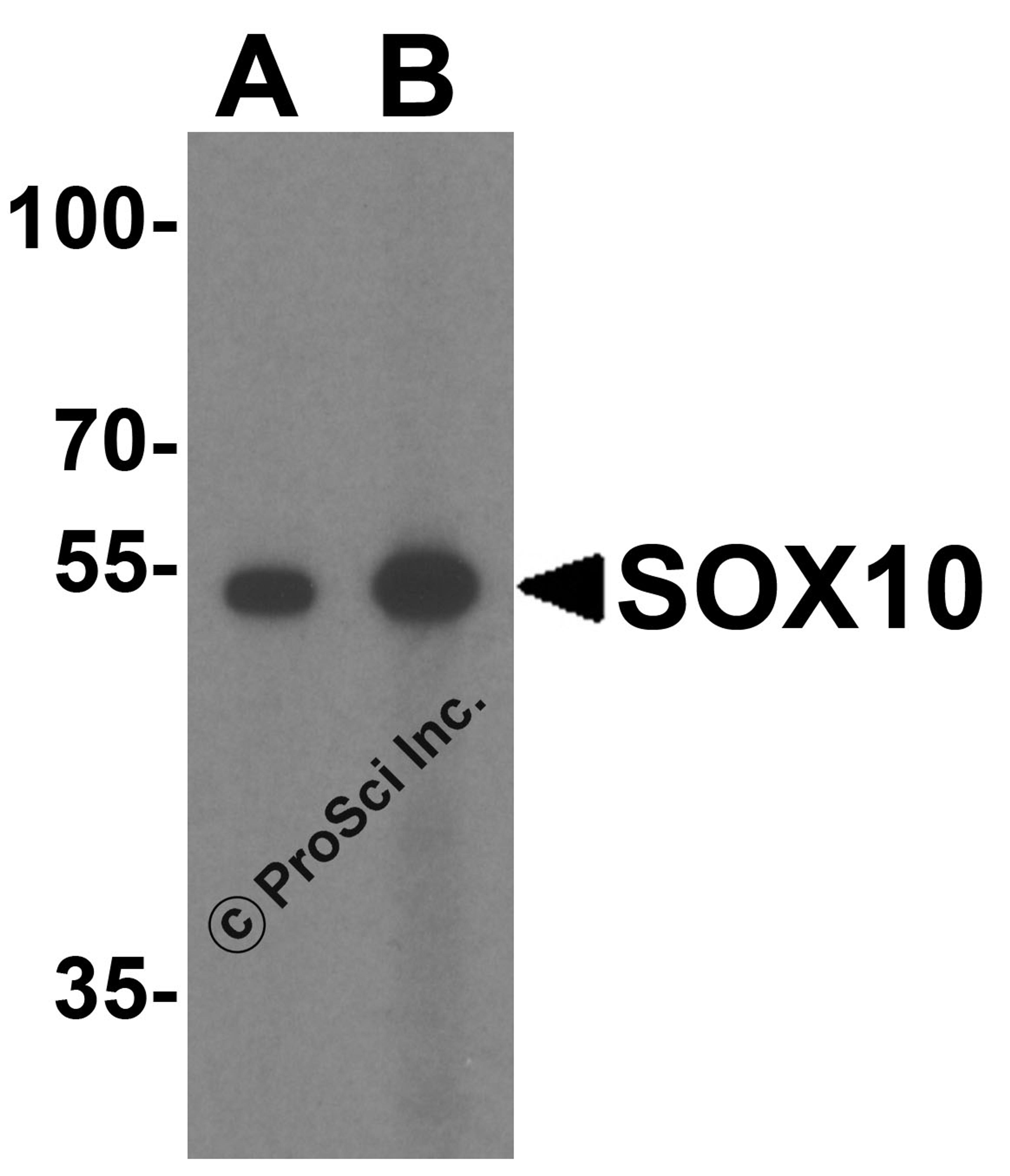 Western blot analysis of SOX10 in rat heart tissue lysate with SOX10 antibody at (A) 1 and (B) 2 μg/mL.