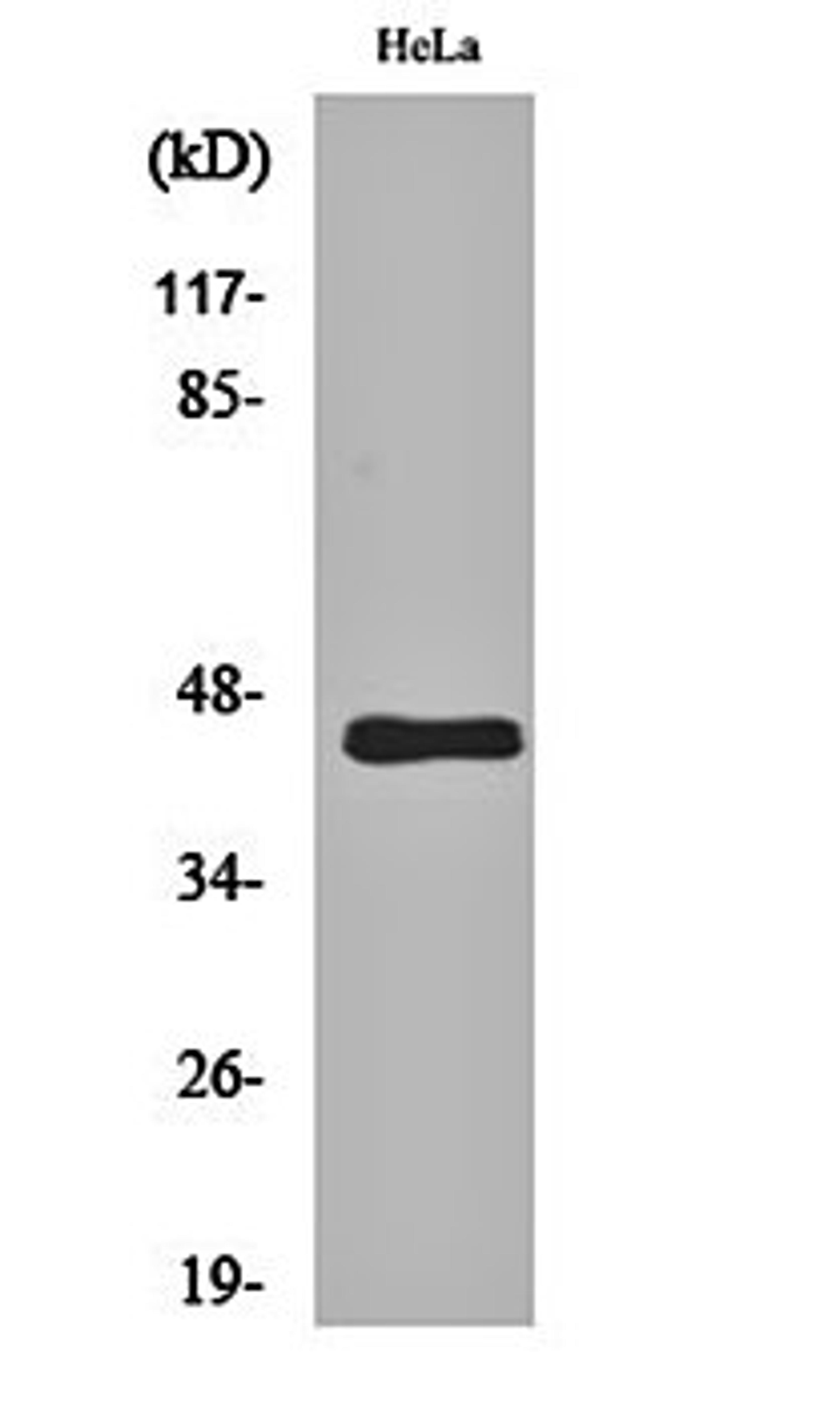 Western blot analysis of Hela cell lysates using GPR38 antibody