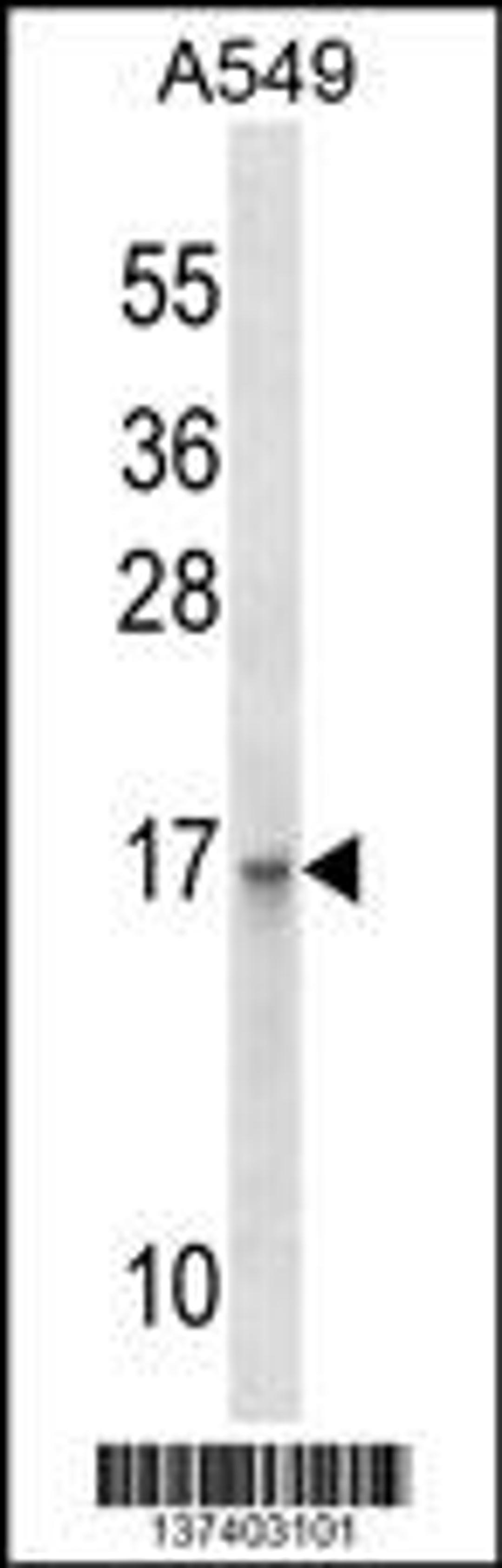 Western blot analysis in A549 cell line lysates (35ug/lane).