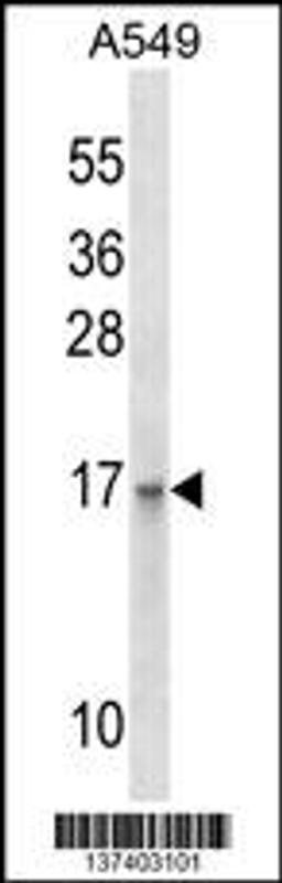 Western blot analysis in A549 cell line lysates (35ug/lane).