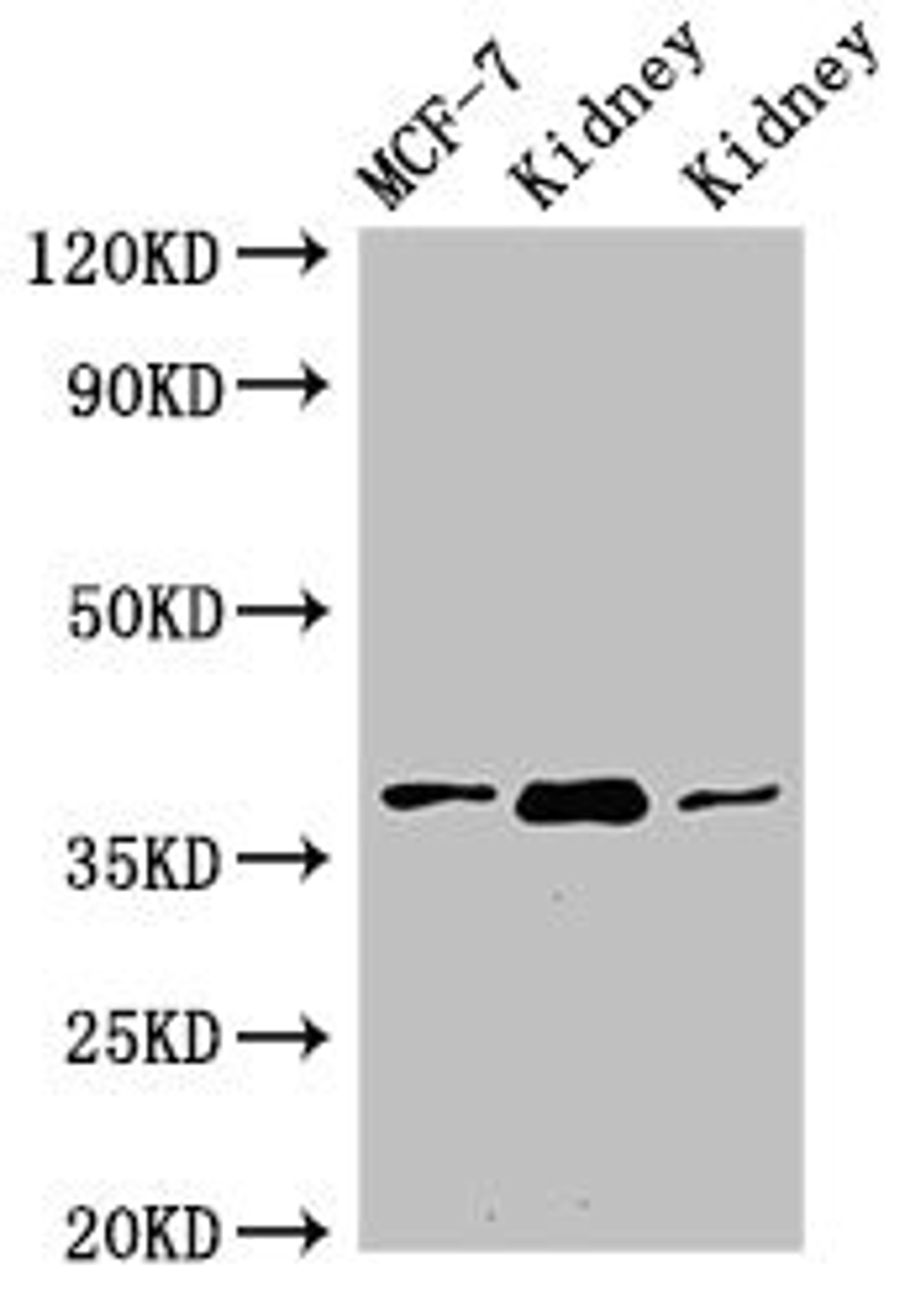 Western Blot. Positive WB detected in: MCF-7 whole cell lysate, Rat kidney tissue, Mouse kidney tissue. All lanes: HAO2 antibody at 3ug/ml. Secondary. Goat polyclonal to rabbit IgG at 1/50000 dilution. Predicted band size: 39, 41 kDa. Observed band size: 39 kDa. 