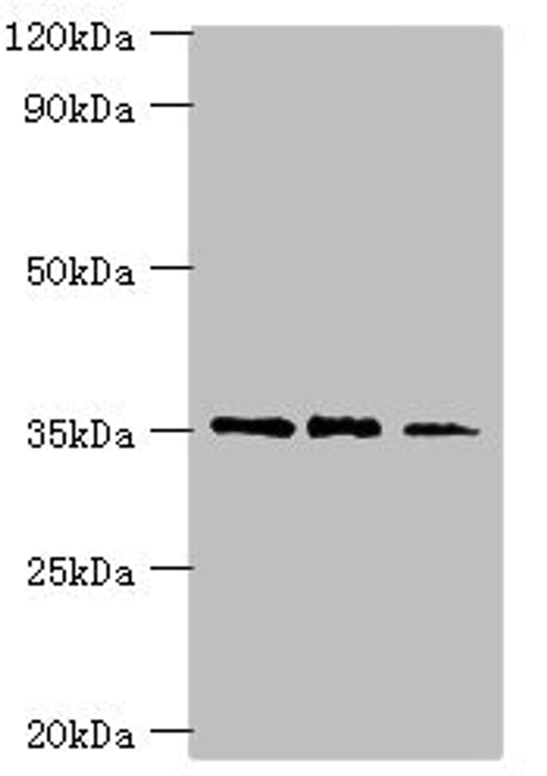 Western blot. All lanes: FOSL2 antibody at 8ug/ml. Lane 1: MCF-7 whole cell lysate. Lane 2: Jurkat whole cell lysate. Lane 3: PC-3 whole cell lysate. Secondary. Goat polyclonal to rabbit IgG at 1/10000 dilution. Predicted band size: 36, 35, 32 kDa. Observed band size: 36 kDa. 