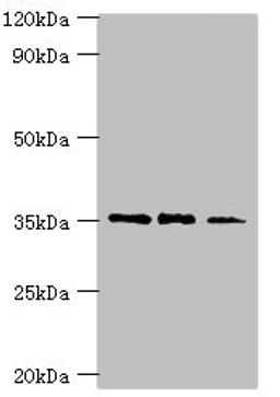 Western blot. All lanes: FOSL2 antibody at 8ug/ml. Lane 1: MCF-7 whole cell lysate. Lane 2: Jurkat whole cell lysate. Lane 3: PC-3 whole cell lysate. Secondary. Goat polyclonal to rabbit IgG at 1/10000 dilution. Predicted band size: 36, 35, 32 kDa. Observed band size: 36 kDa. 