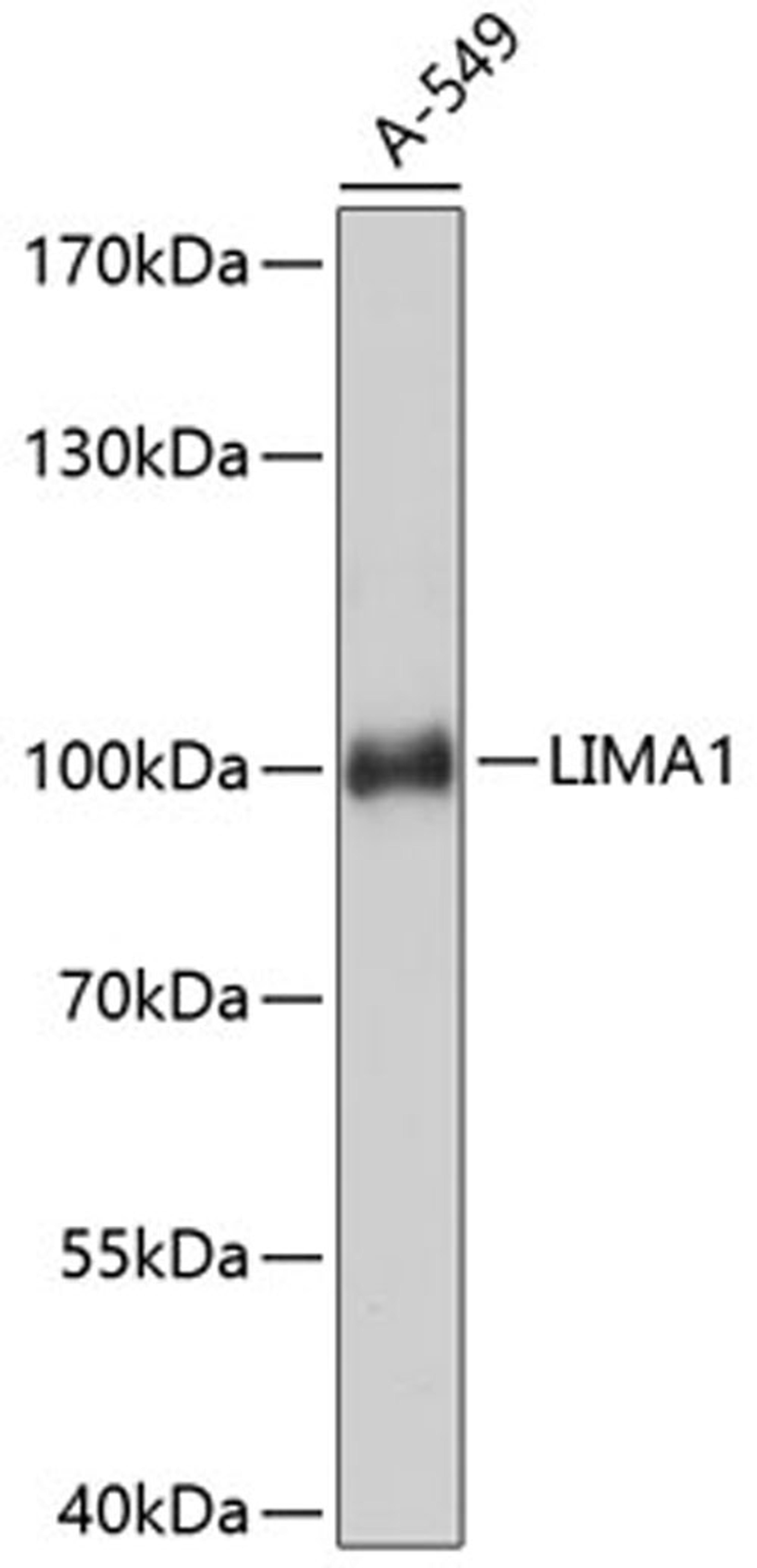 Western blot - LIMA1 antibody (A11682)