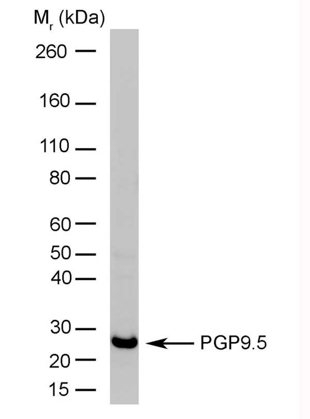 Rat brain lysate probed with Mouse anti Human Protein Gene Product 9.5 by western blotting