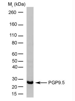 Rat brain lysate probed with Mouse anti Human Protein Gene Product 9.5 by western blotting