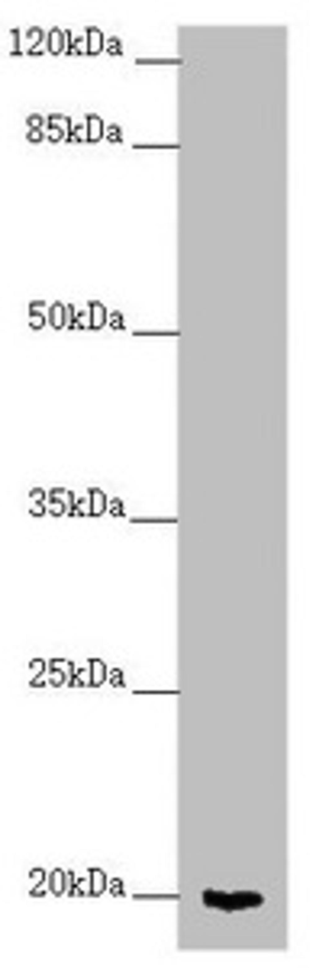Western blot. All lanes: CETN1 antibody at 2.7 ug/ml + Mouse gonadal tissue. Secondary. Goat polyclonal to rabbit IgG at 1/10000 dilution. Predicted band size: 20 kDa. Observed band size: 20 kDa. 