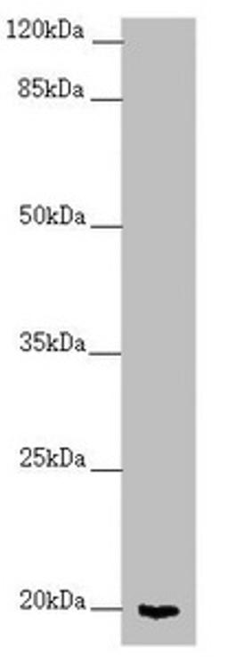 Western blot. All lanes: CETN1 antibody at 2.7 ug/ml + Mouse gonadal tissue. Secondary. Goat polyclonal to rabbit IgG at 1/10000 dilution. Predicted band size: 20 kDa. Observed band size: 20 kDa. 