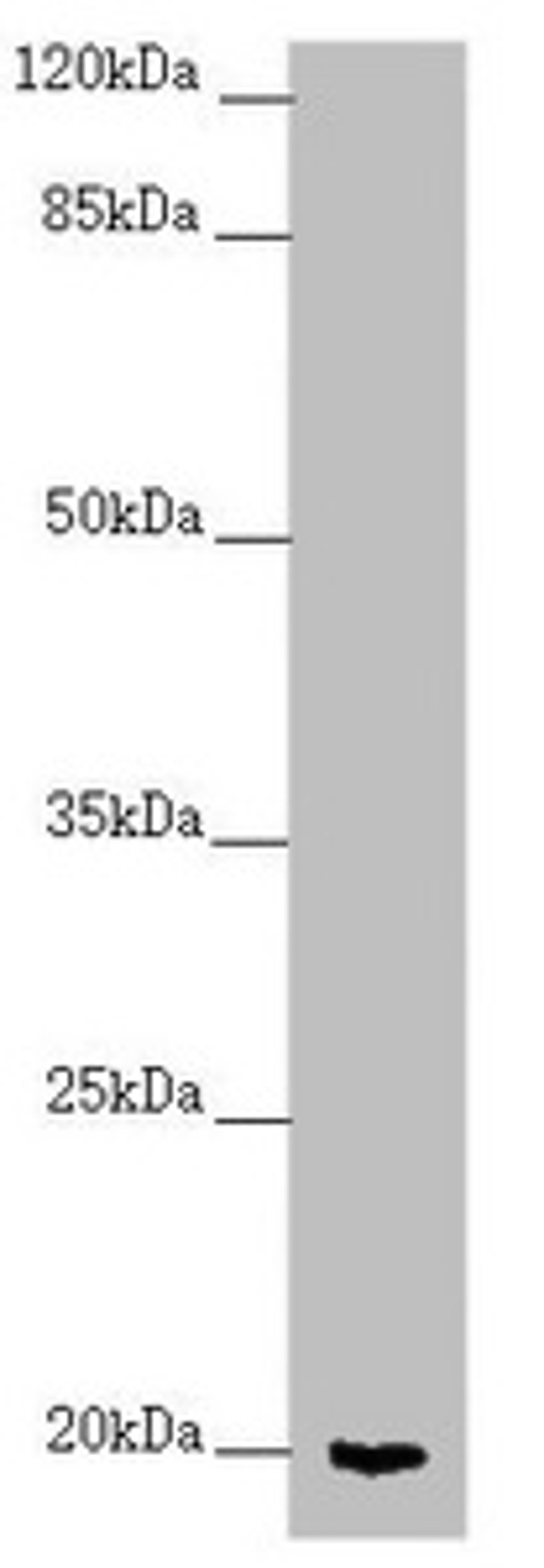 Western blot. All lanes: CETN1 antibody at 2.7 ug/ml + Mouse gonadal tissue. Secondary. Goat polyclonal to rabbit IgG at 1/10000 dilution. Predicted band size: 20 kDa. Observed band size: 20 kDa. 