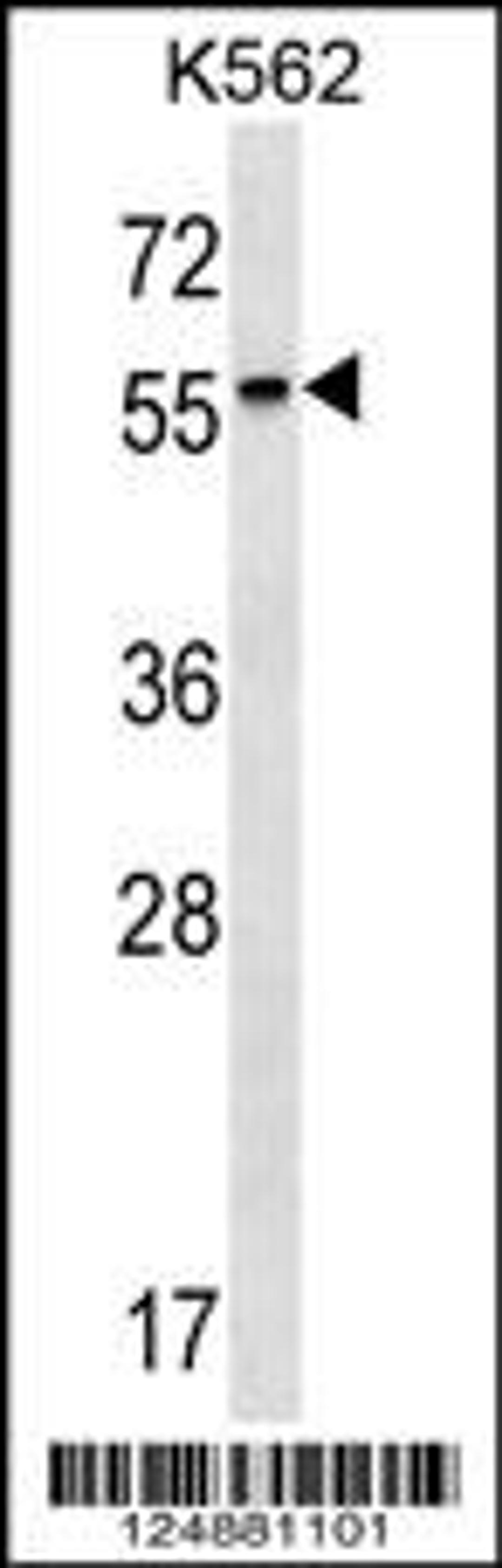 Western blot analysis in K562 cell line lysates (35ug/lane).