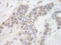 Detection of human CDK8 by immunohistochemistry.