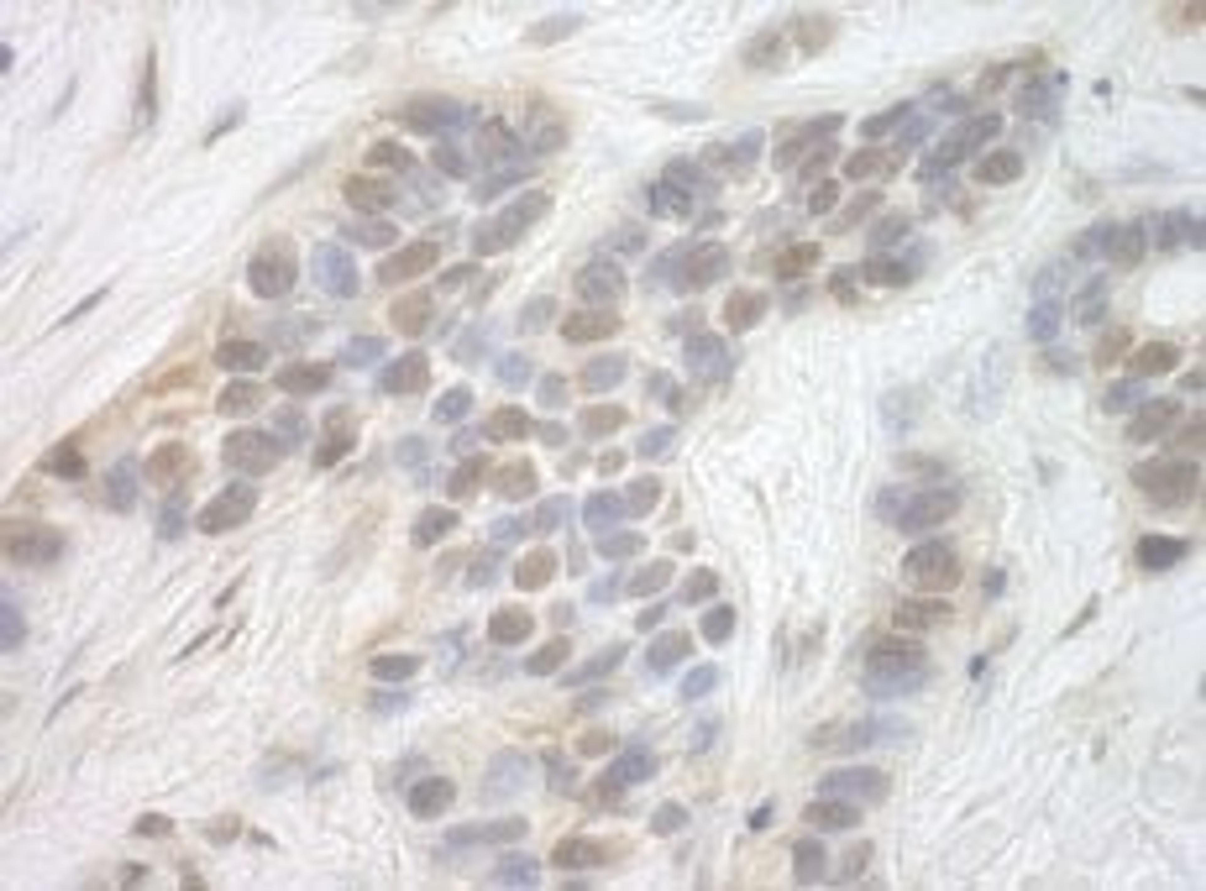 Detection of human CDK8 by immunohistochemistry.