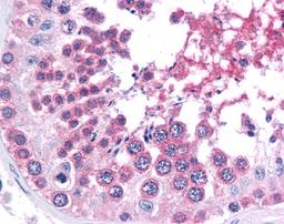 Immunohistochemistry of human testis tissue stained using BRG1 Monoclonal Antibody.