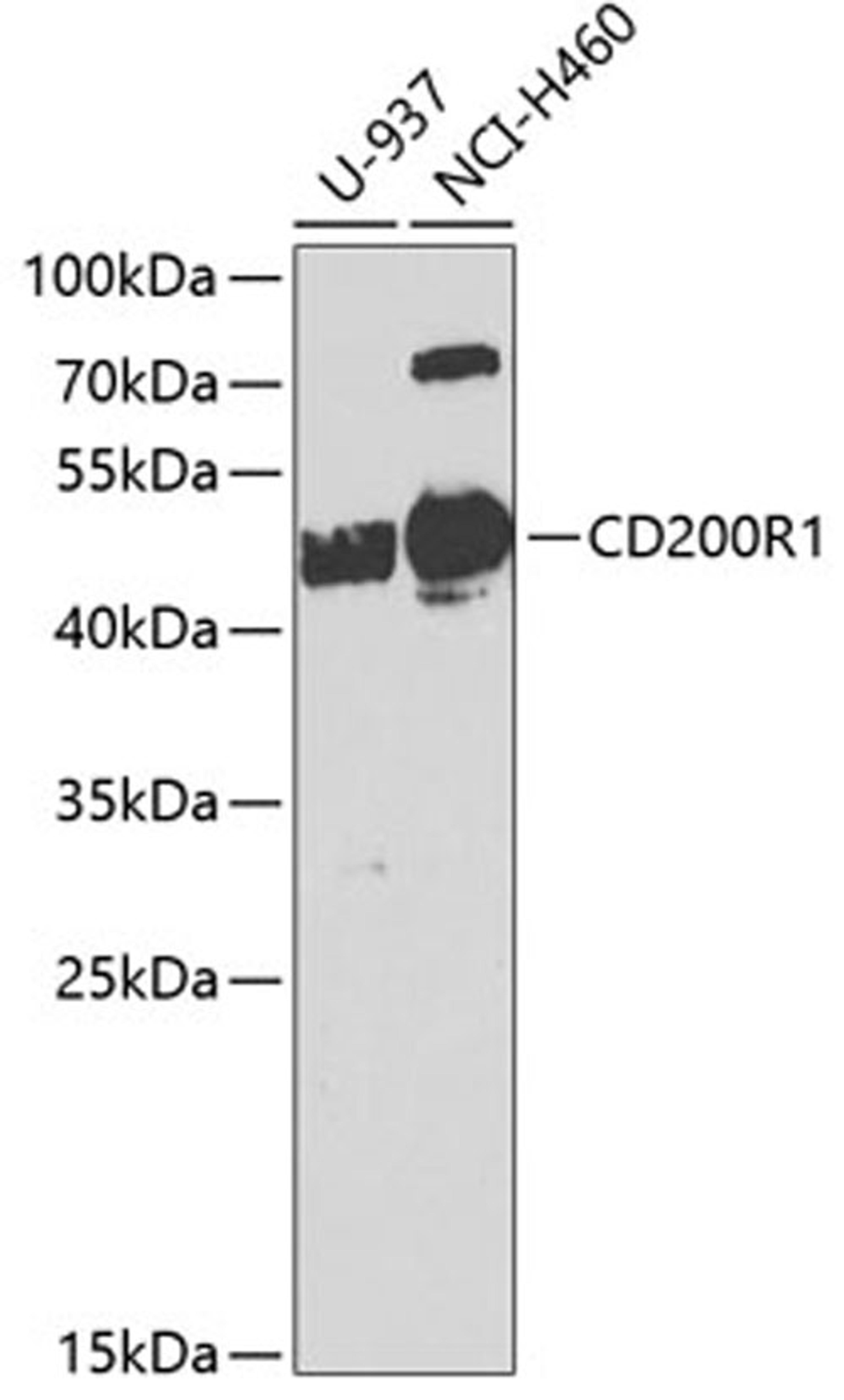 Western blot - CD200R1 antibody (A8278)